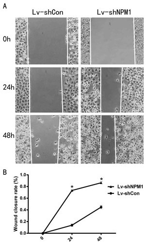 An npm1 knockout human bladder cancer t24/ddp cell line