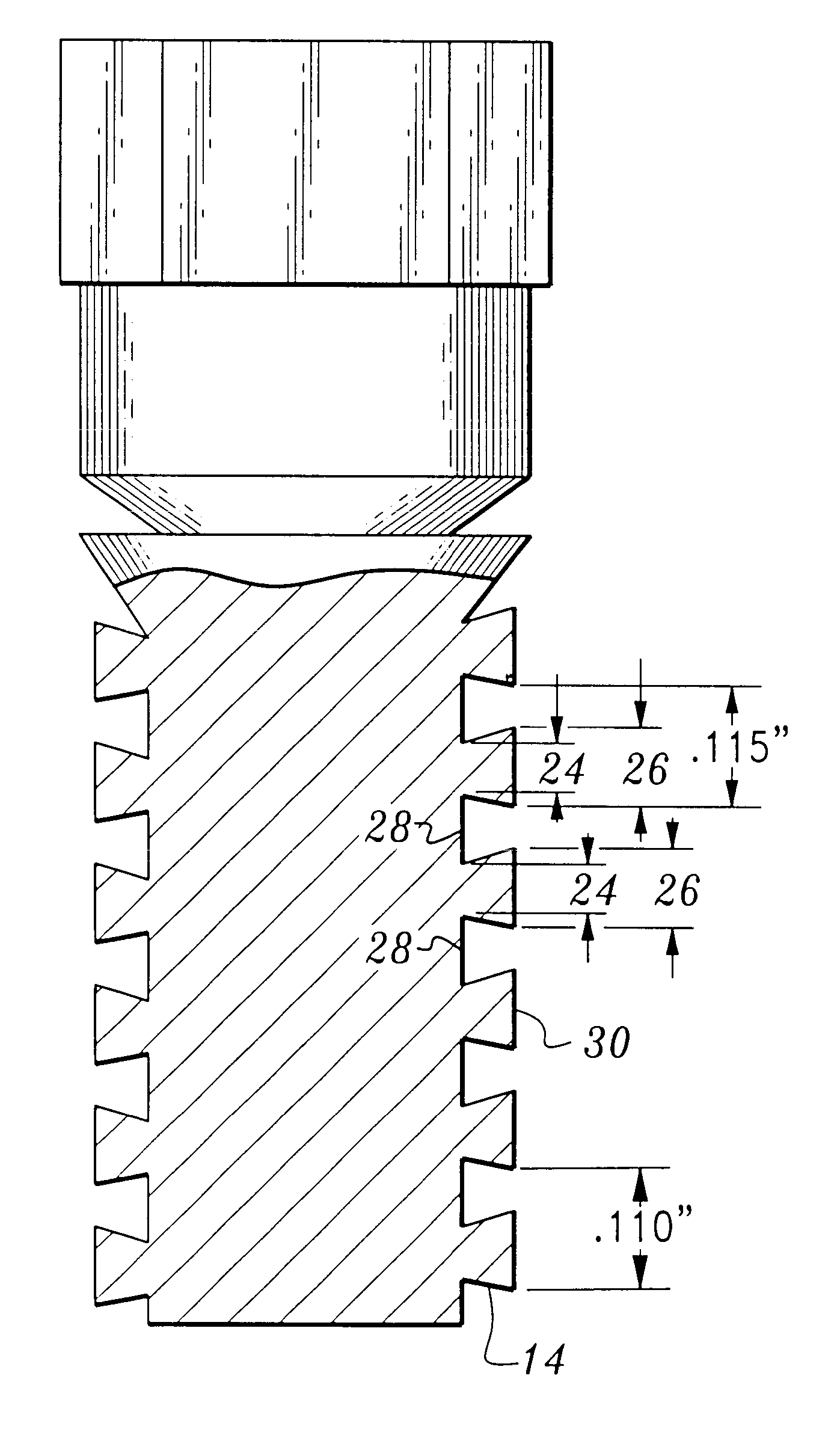 Threaded fastener having a thread crest greater than its thread root