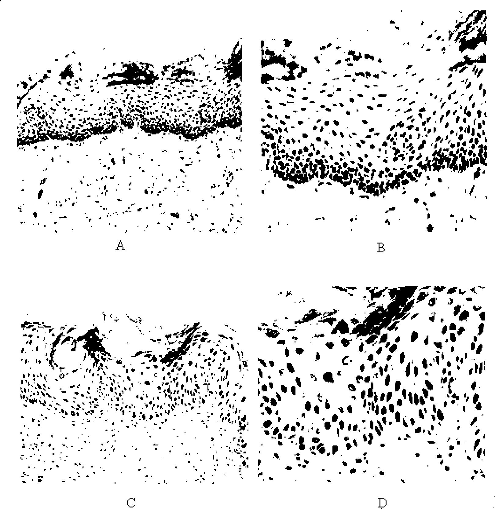 Oral cavity squamous carcinoma diagnosis reagent, reagent kit and preventing and controlling medicament