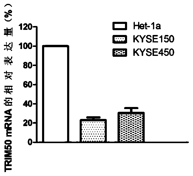 Application of trim50 in the diagnosis and treatment of esophageal squamous cell carcinoma