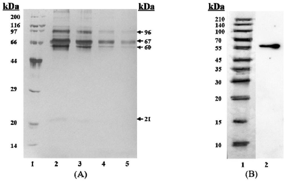 A method for detecting human soluble asialoglycoprotein receptor