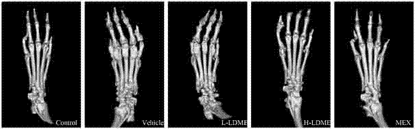 Application of levodopa methyl ester hydrochloride in the preparation of drugs for preventing and treating rheumatoid arthritis