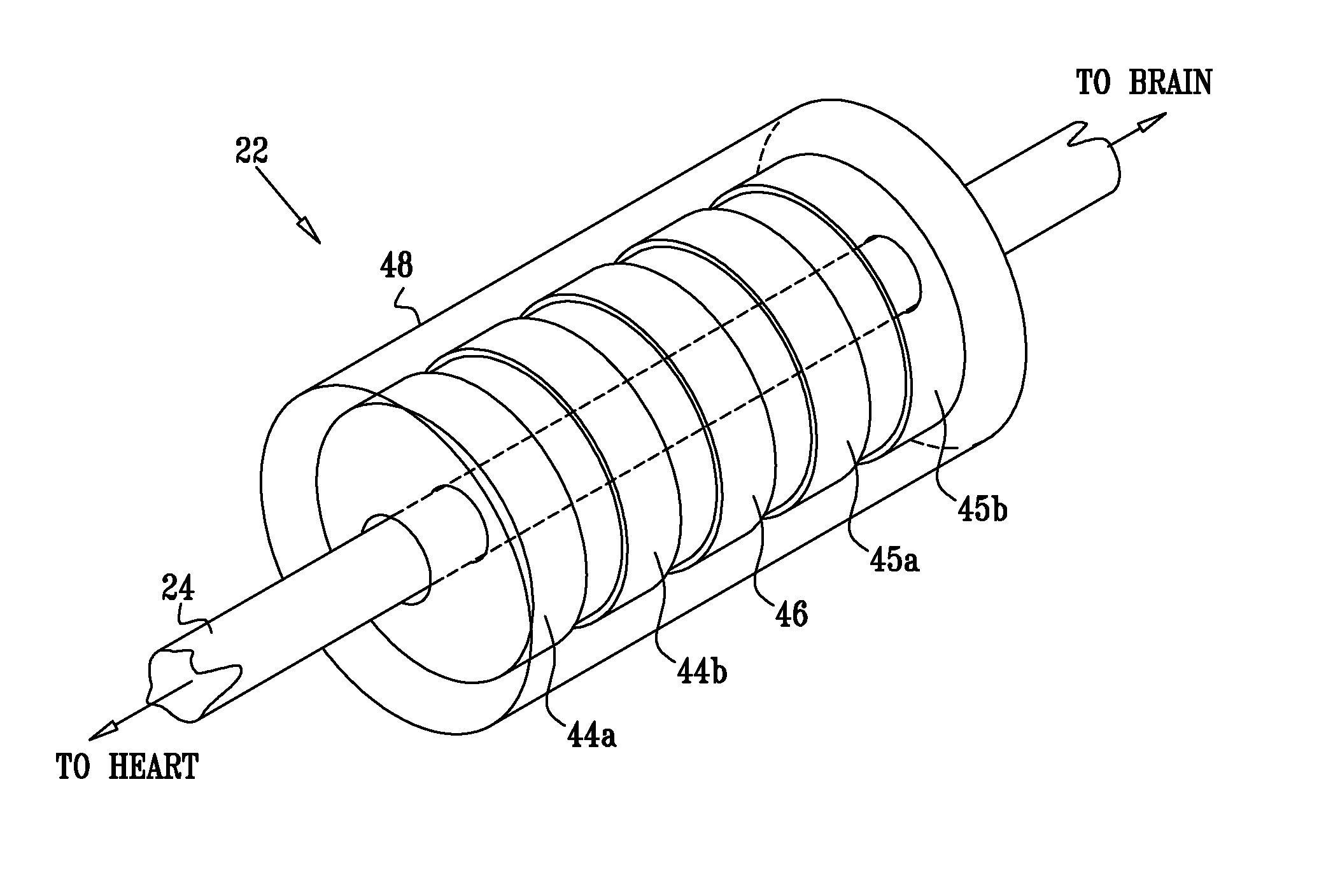 Dissolvable electrode device