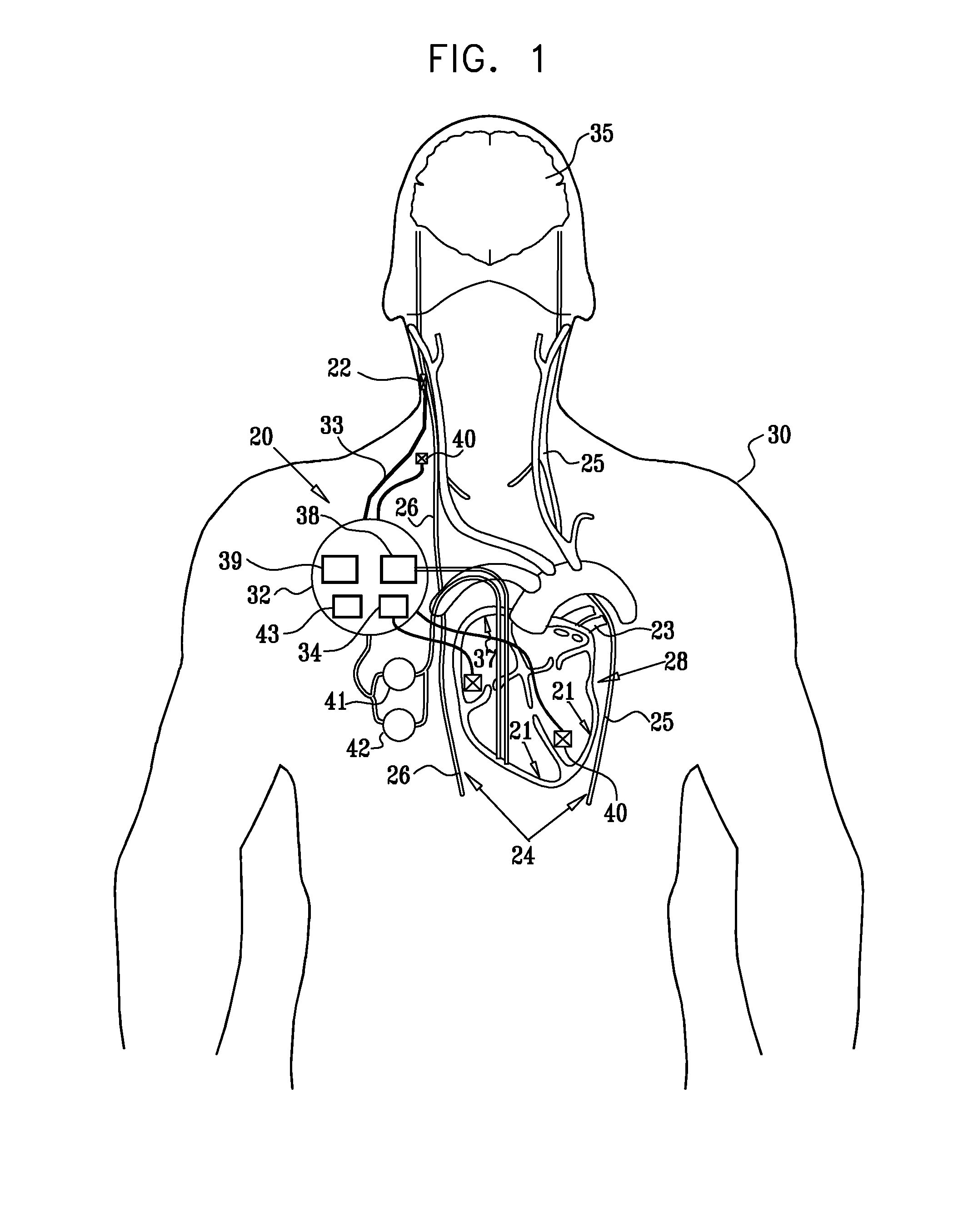 Dissolvable electrode device