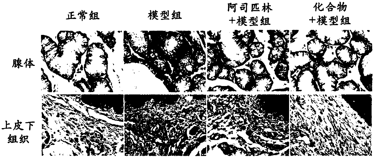 Novel application of compound in treatment of pharyngitis