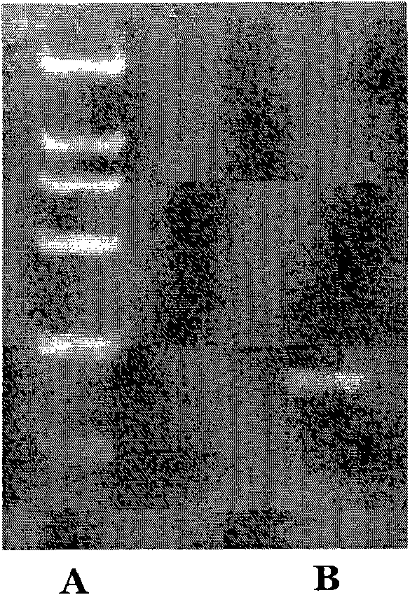 Method for detecting PCR of toxoplasmas