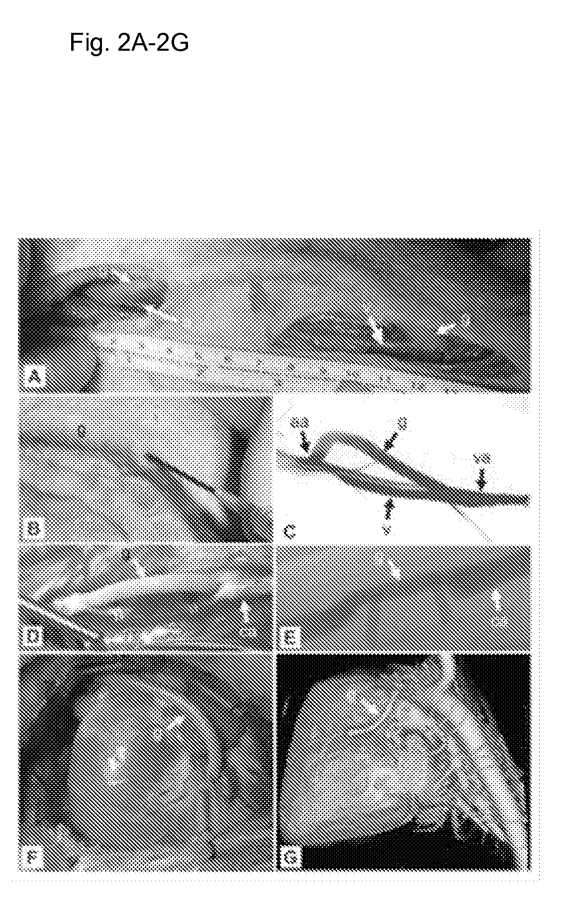 Tissue-Engineered Constructs