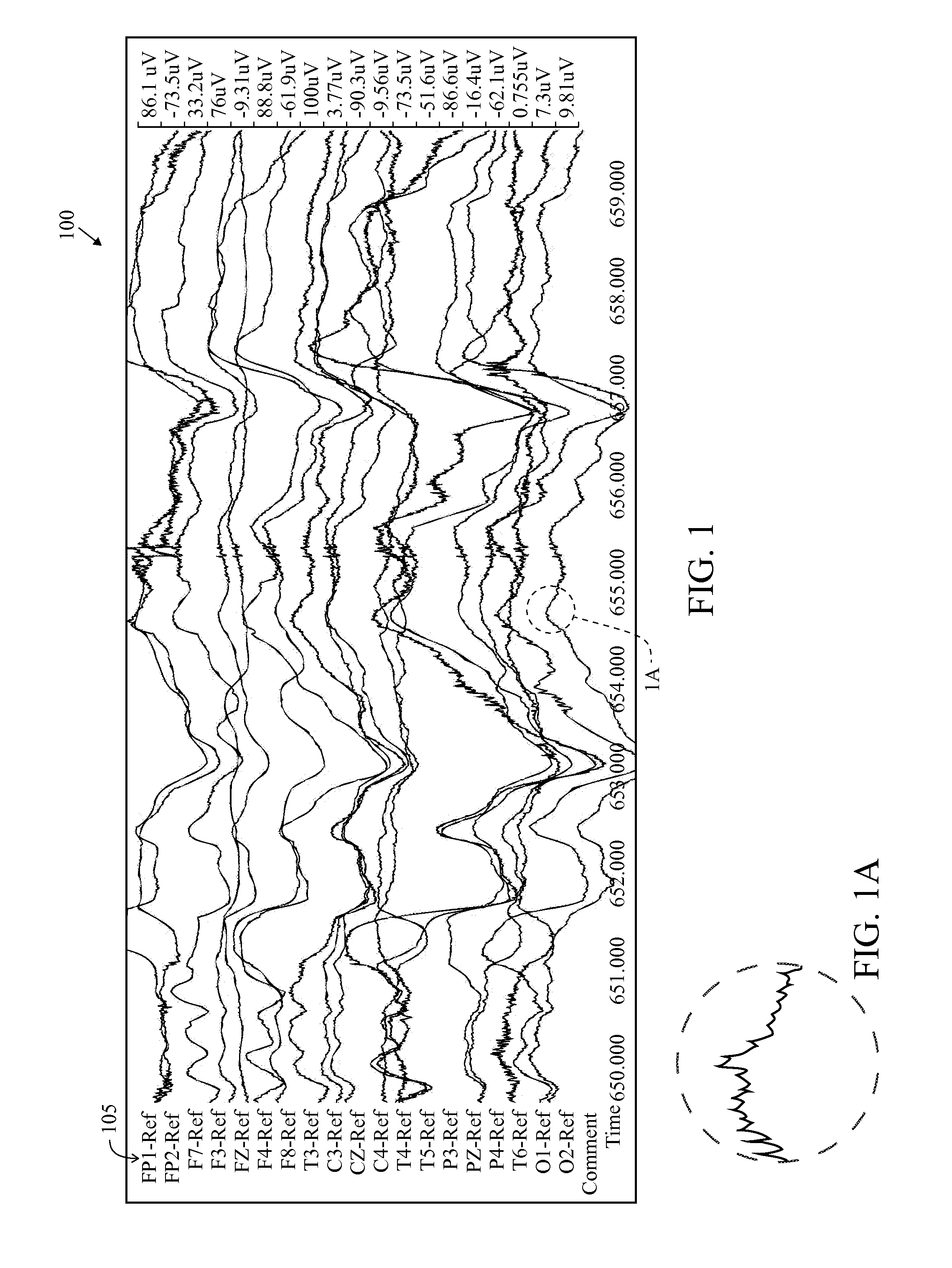 User Interface For Artifact Removal In An EEG