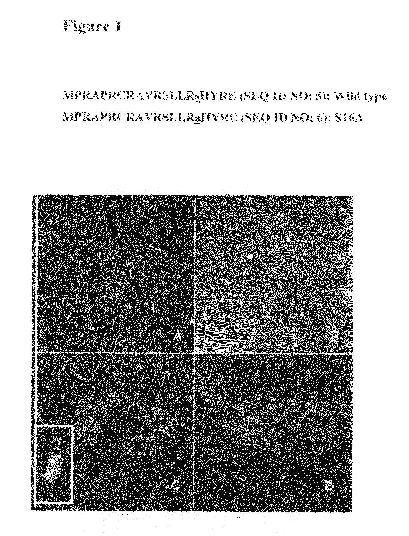 Nuclear telomerase reverse transcriptase variant