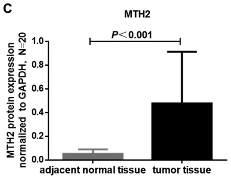 A marker for judging the prognosis of colorectal cancer and its application