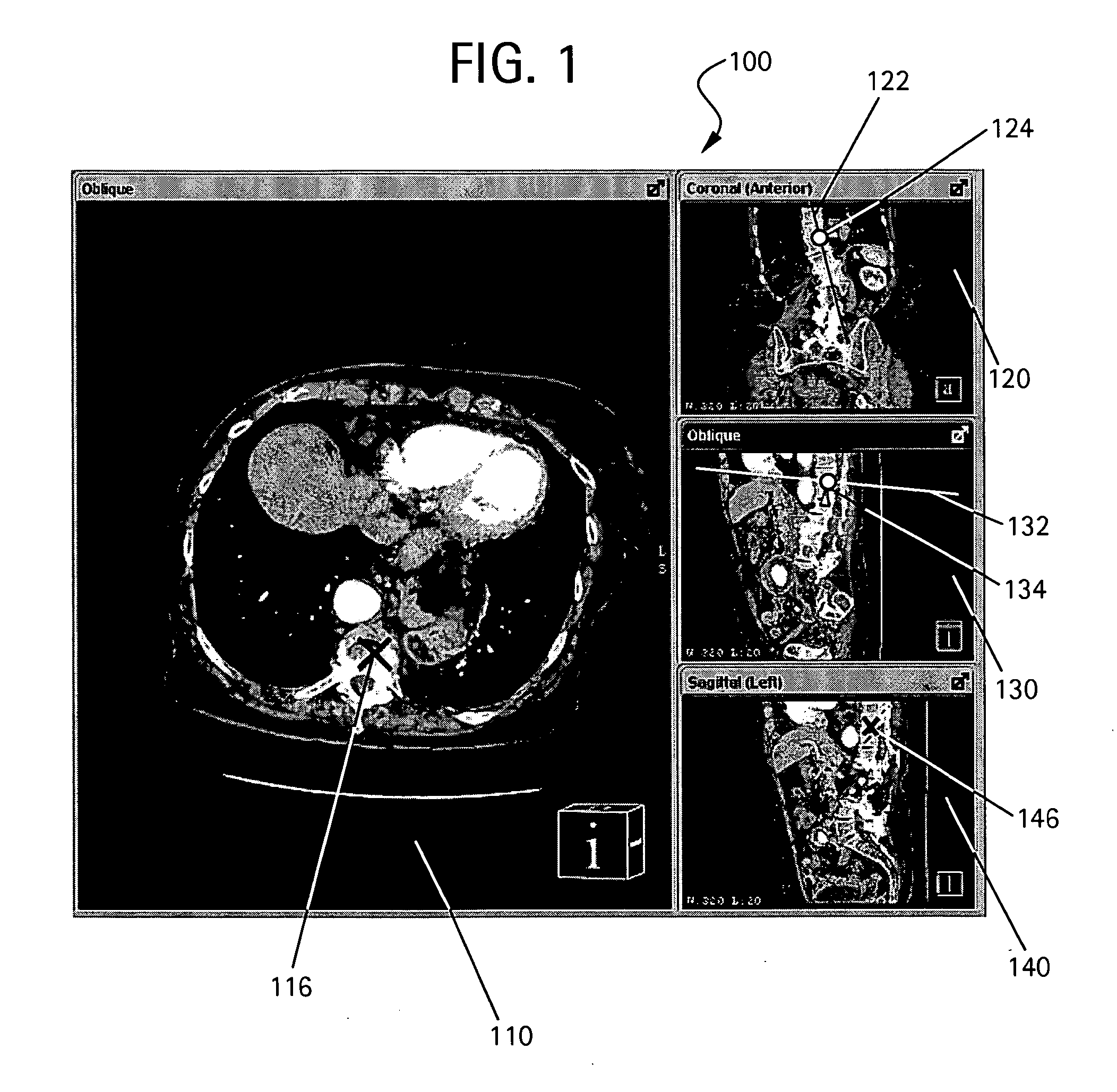 Method to define the 3D oblique cross-section of anatomy at a specific angle and be able to easily modify multiple angles of display simultaneously