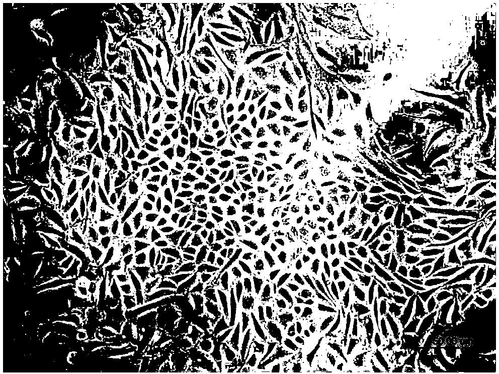 Method for expanding pancreatic beta cell in vitro