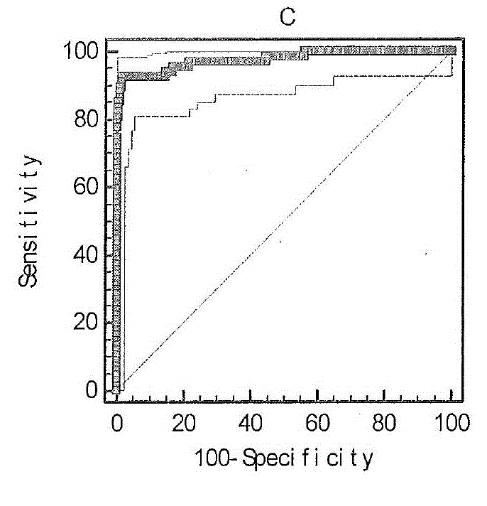 Kit for detecting liver fibration and liver cirrhosis