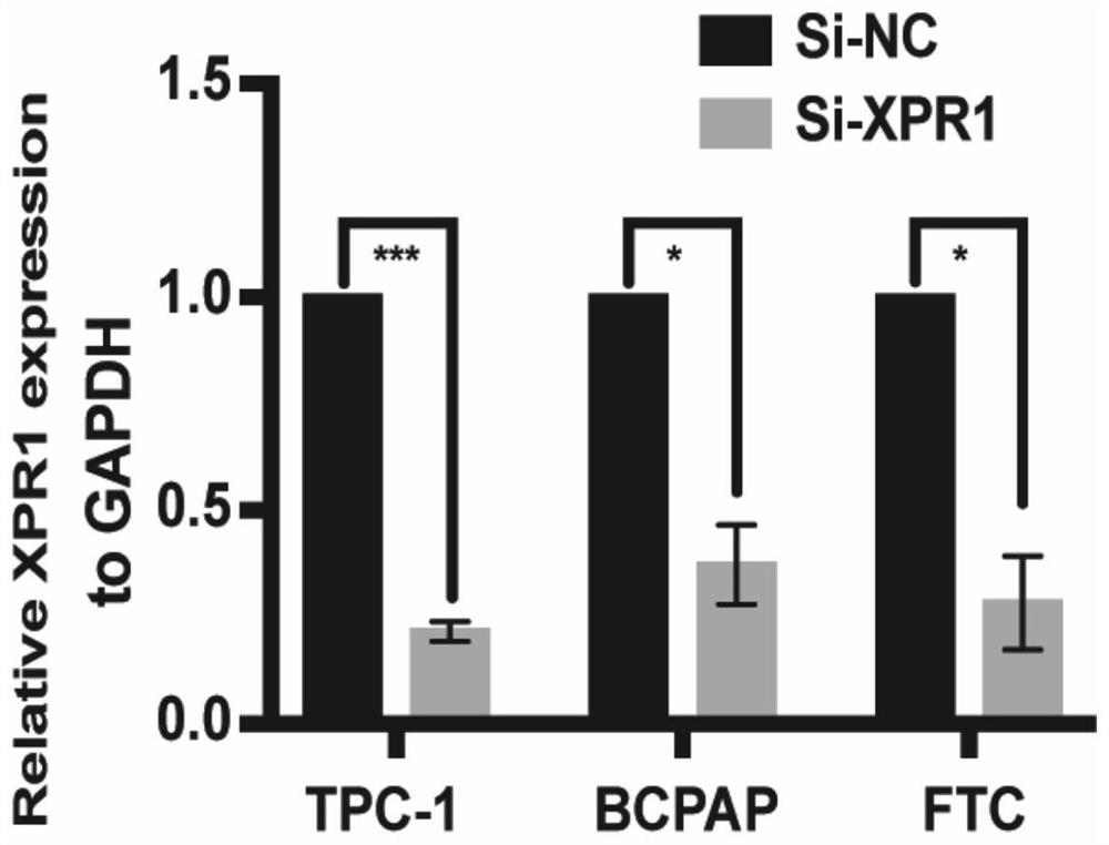 Application of XPR1 inhibitor in preparation of product for inhibiting migration and/or proliferation of thyroid cancer cells