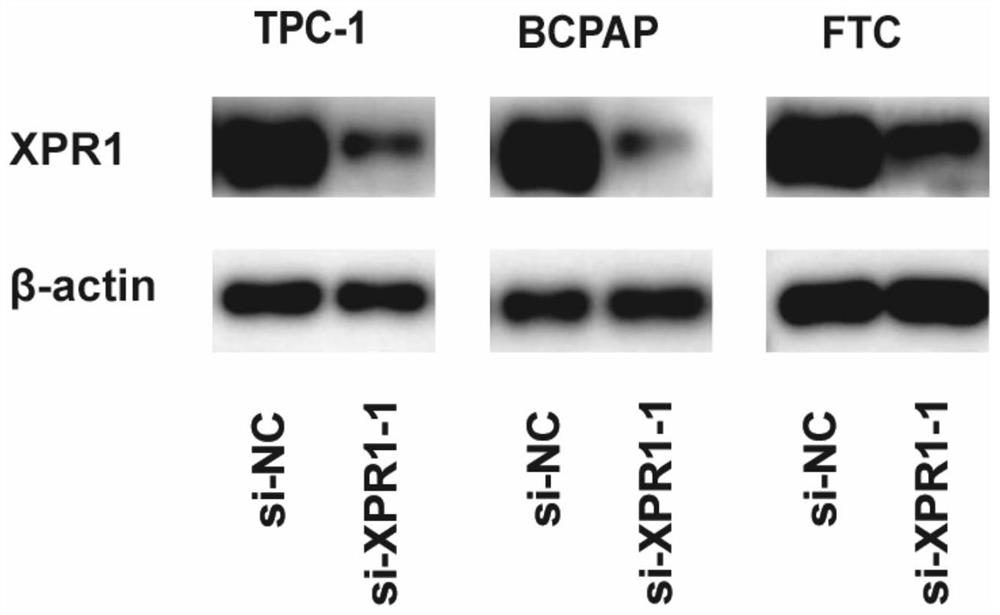 Application of XPR1 inhibitor in preparation of product for inhibiting migration and/or proliferation of thyroid cancer cells