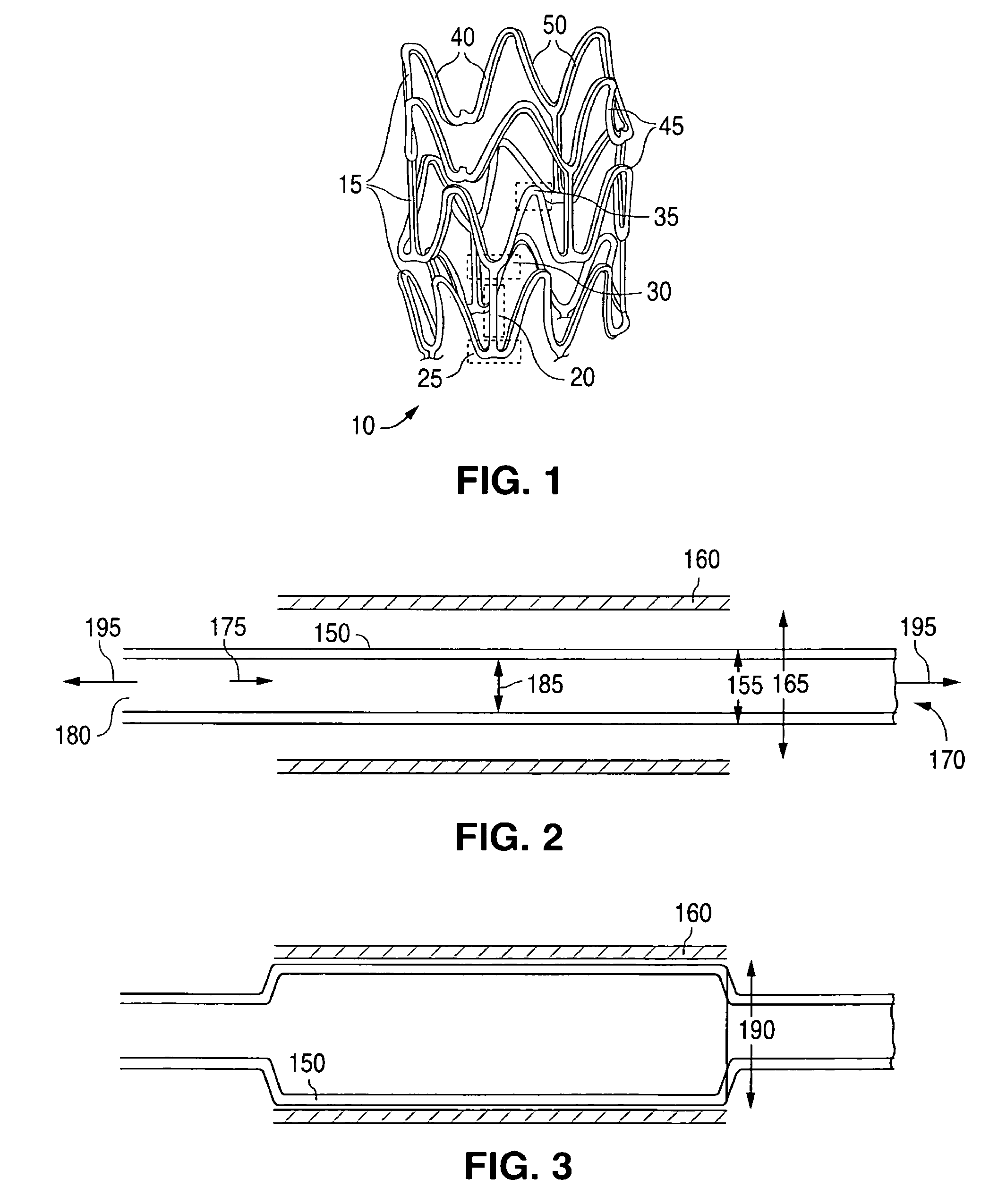 Manufacturing process for polymetric stents