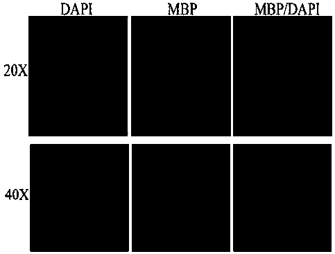 Method for separating and purifying oligodendrocyte precursor cells of cerebral cortex of tupaia belangeri in vitro