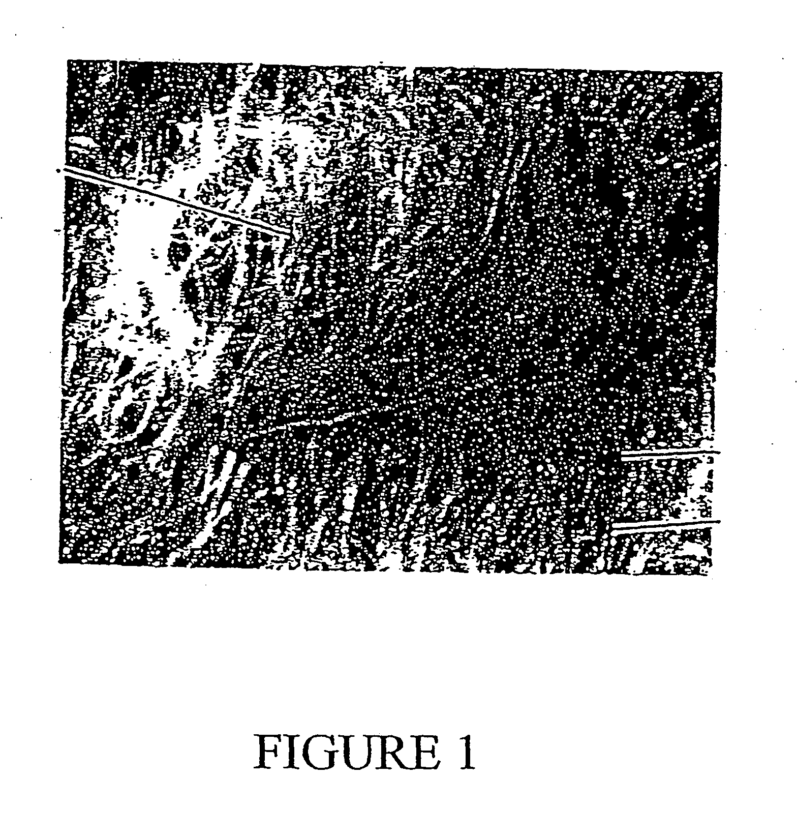 Facemask with filtering closure