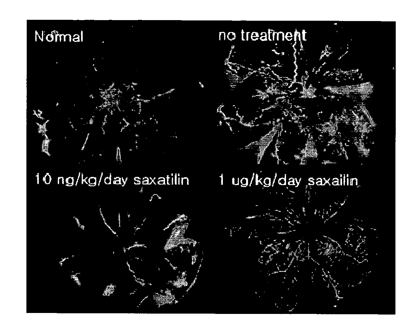 Polypeptide Inducing the Secretion of Angiopoietin