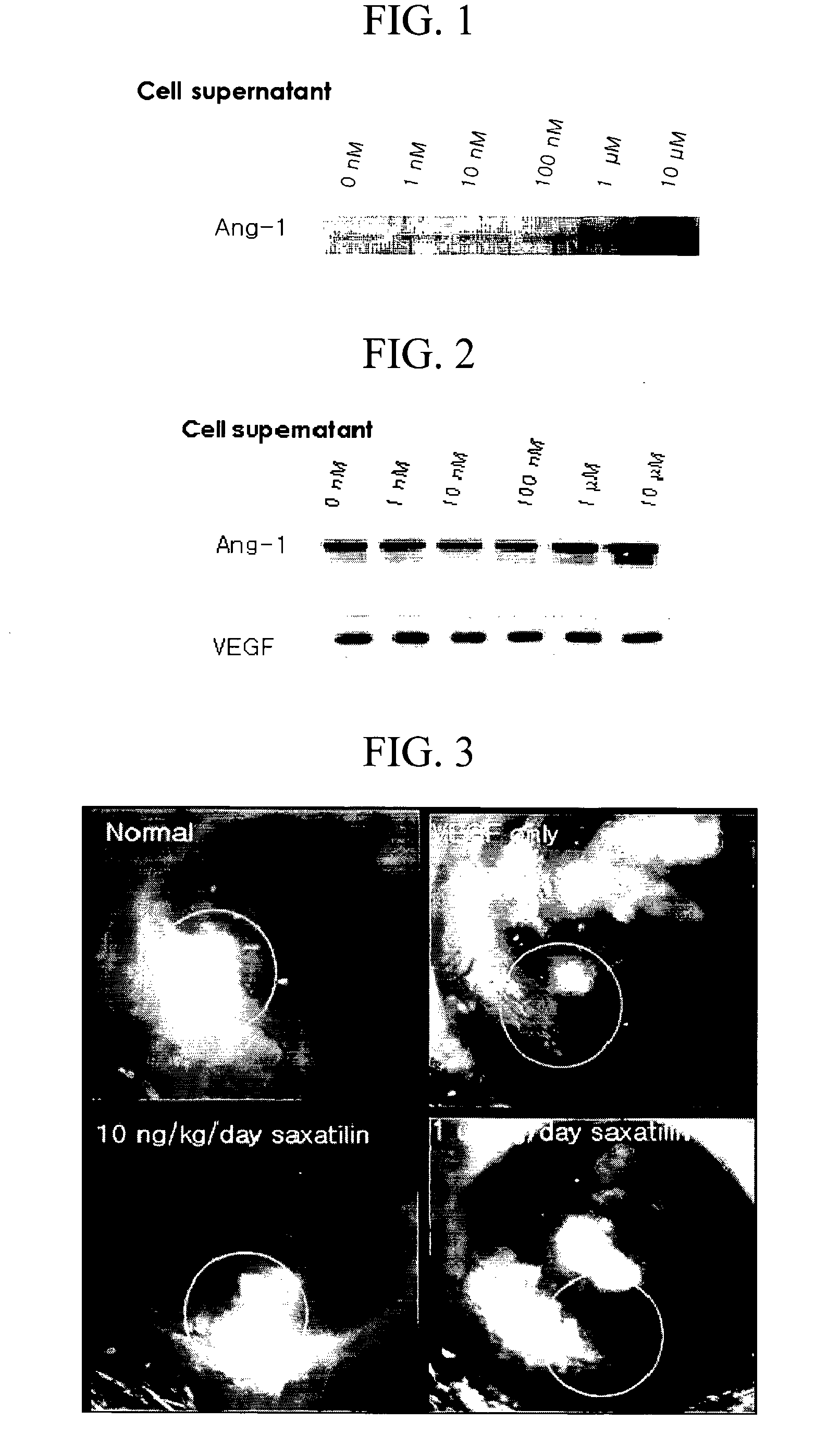 Polypeptide Inducing the Secretion of Angiopoietin