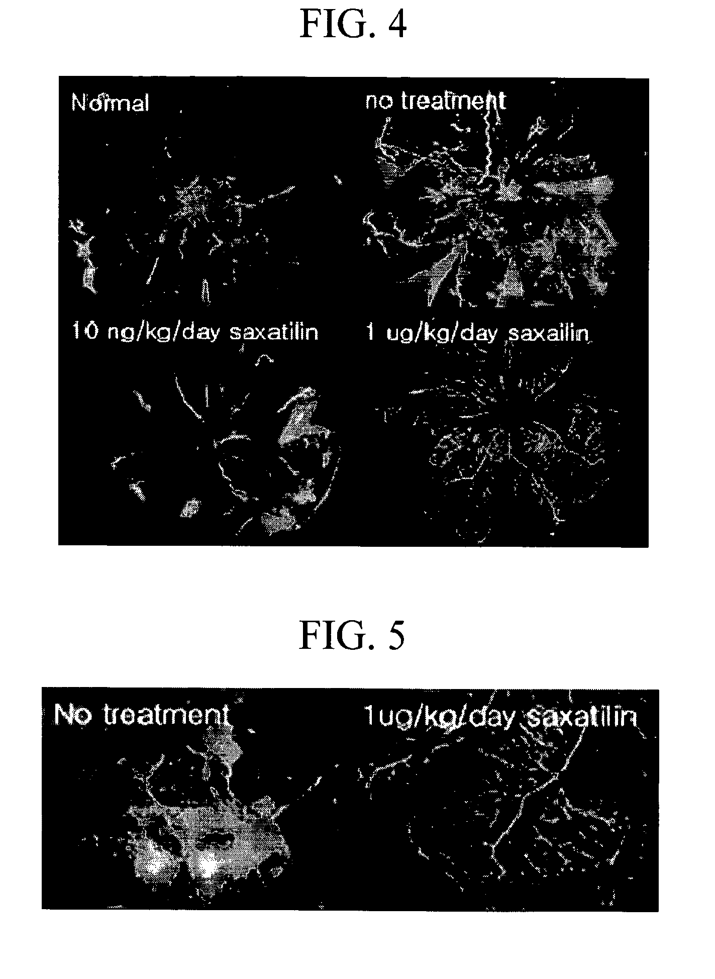 Polypeptide Inducing the Secretion of Angiopoietin