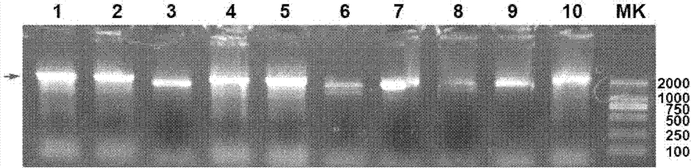 Preparation and application of her2-neu antigen-positive tumor therapeutic vaccine