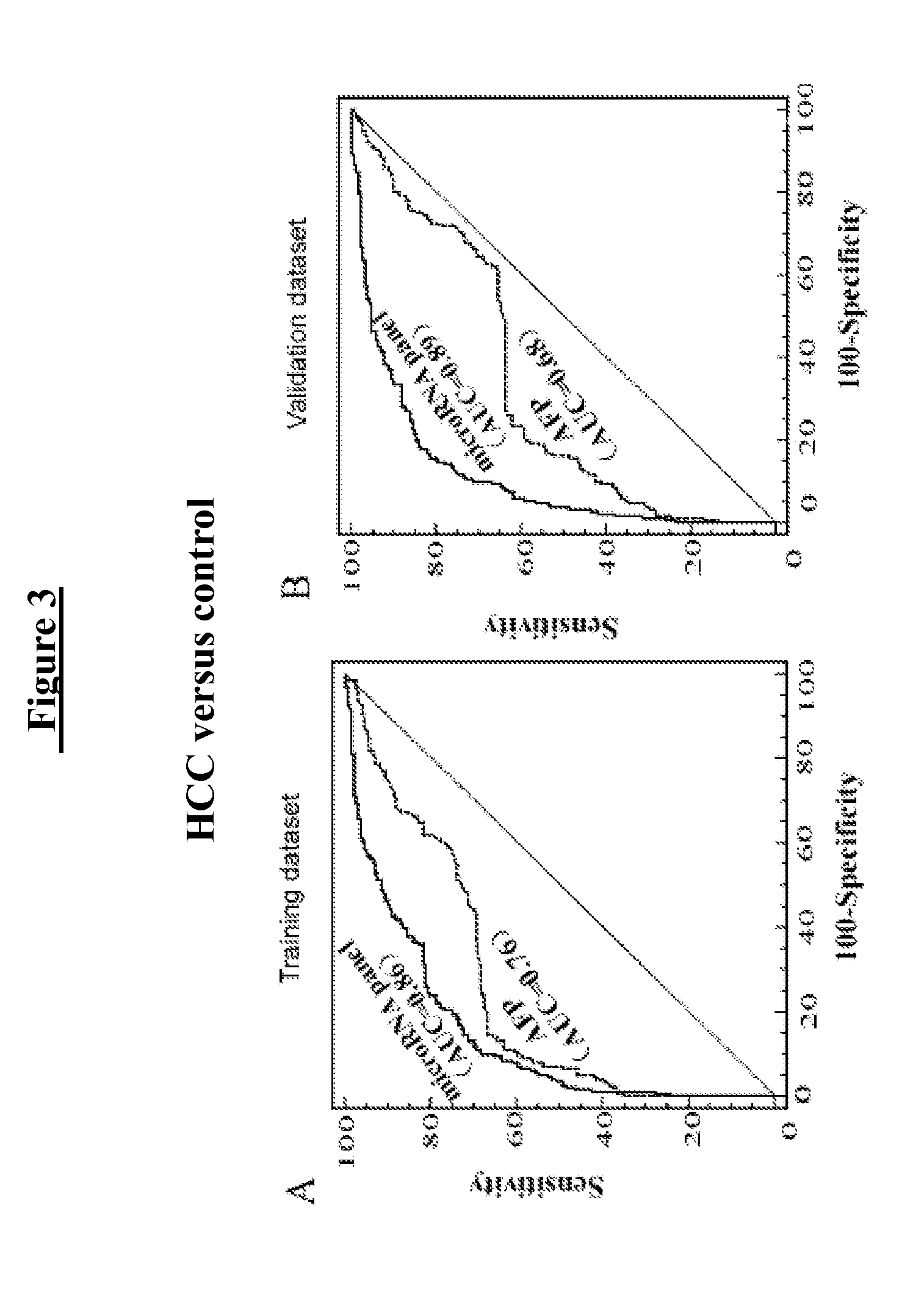 Marker consisting of plasma microrna and a new method for diagnosis of hepatocellular carcinoma