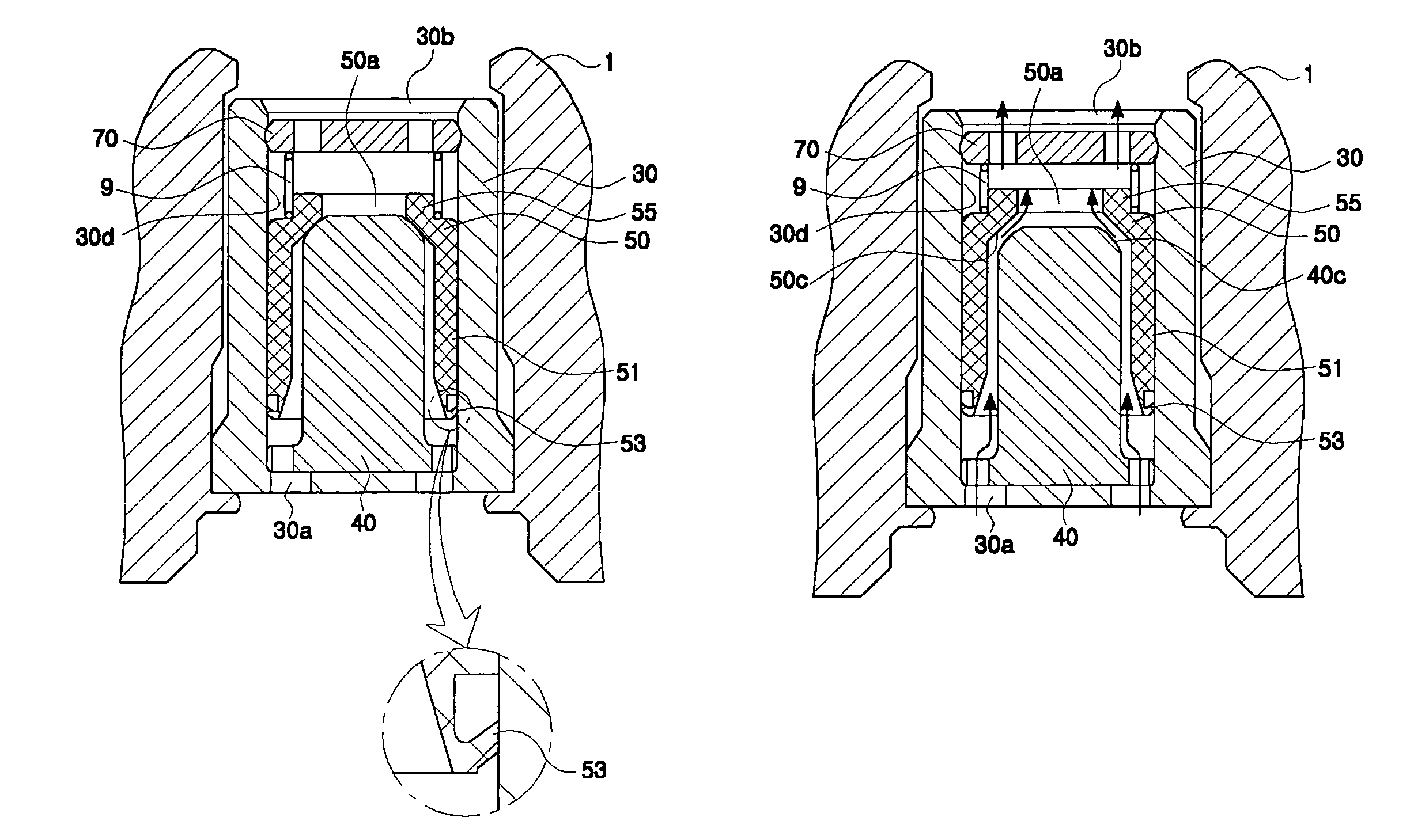 Check valve for pump of electronically controlled brake system