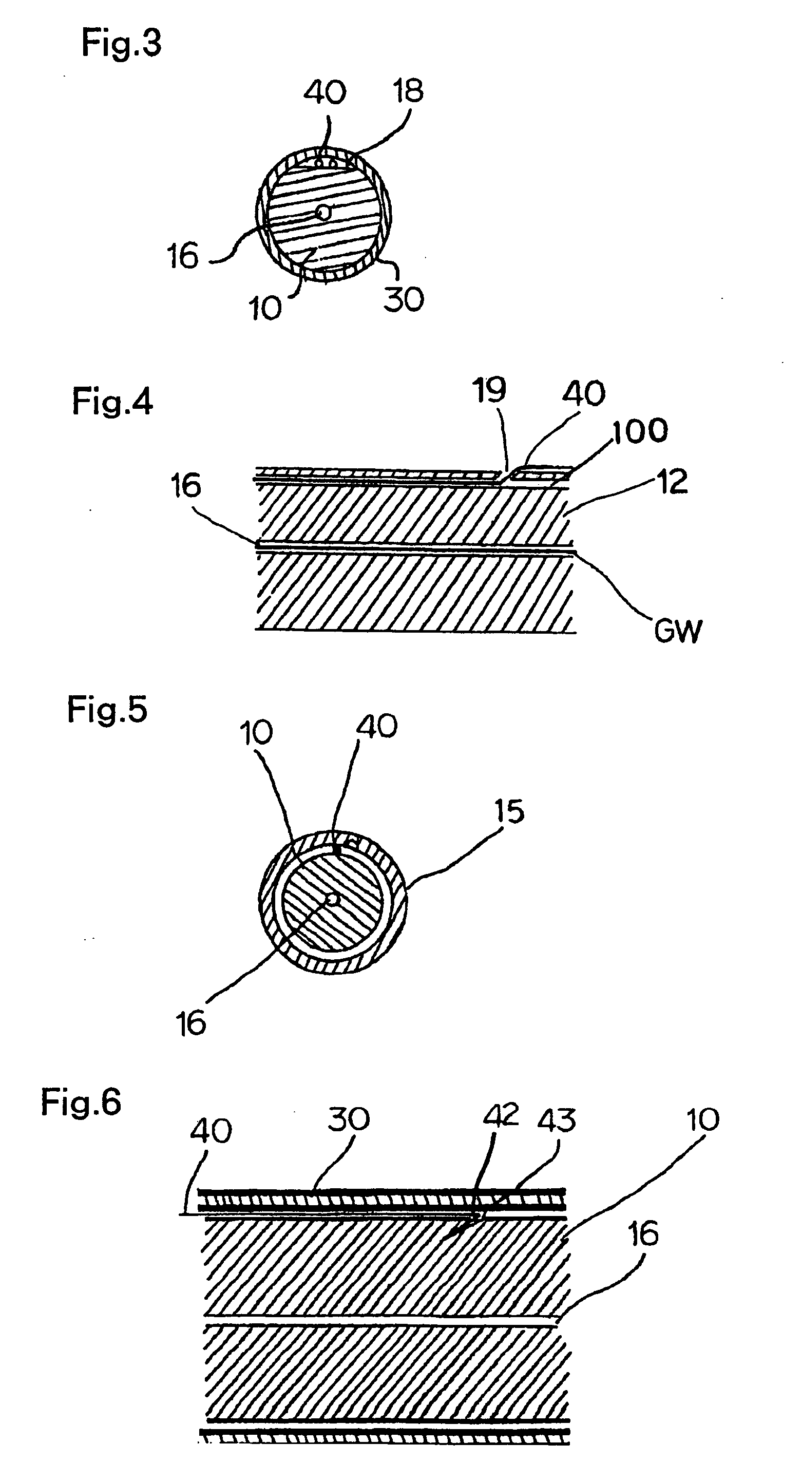 Stent Graft Indwelling Device And Fixed Chip