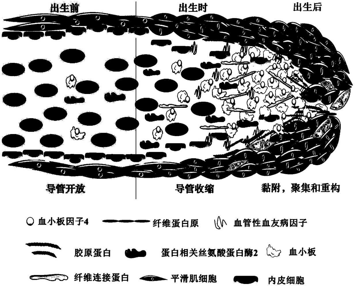 Application of multi-protein composition and congenital heart disease screening kit