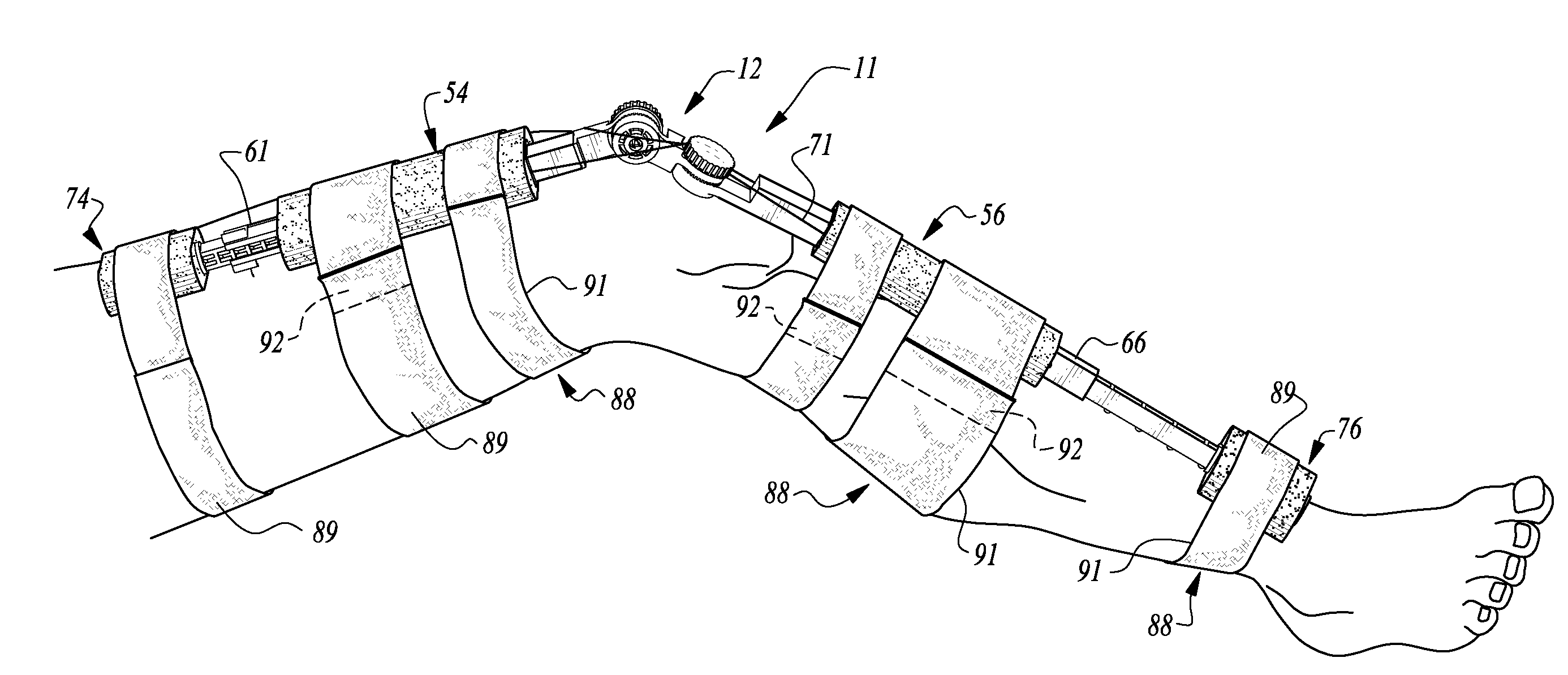 Sterile Tensor Cravats And Methods For Storing And Deploying Same