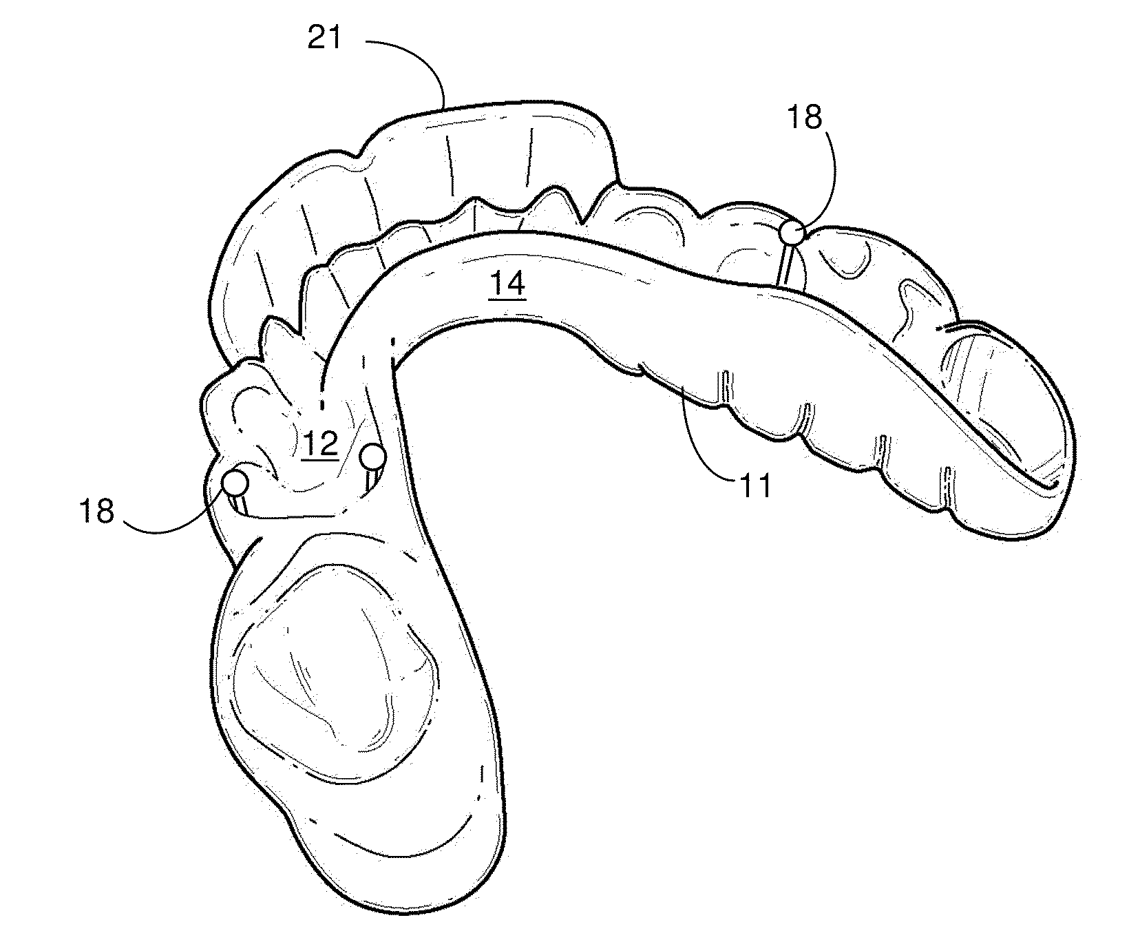 Dental Splint