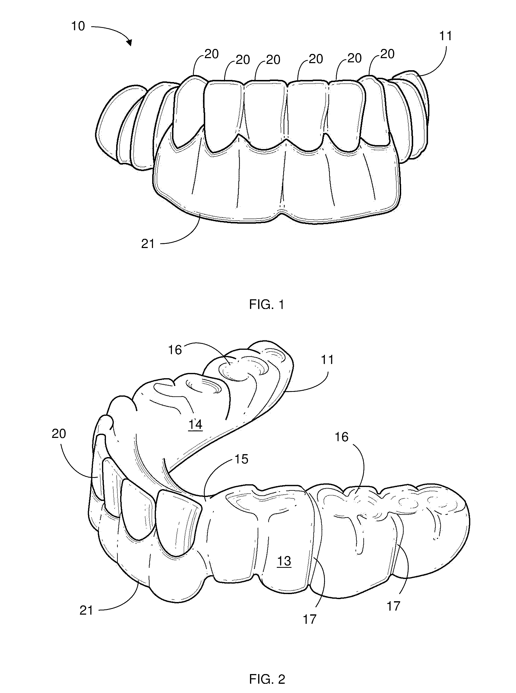 Dental Splint