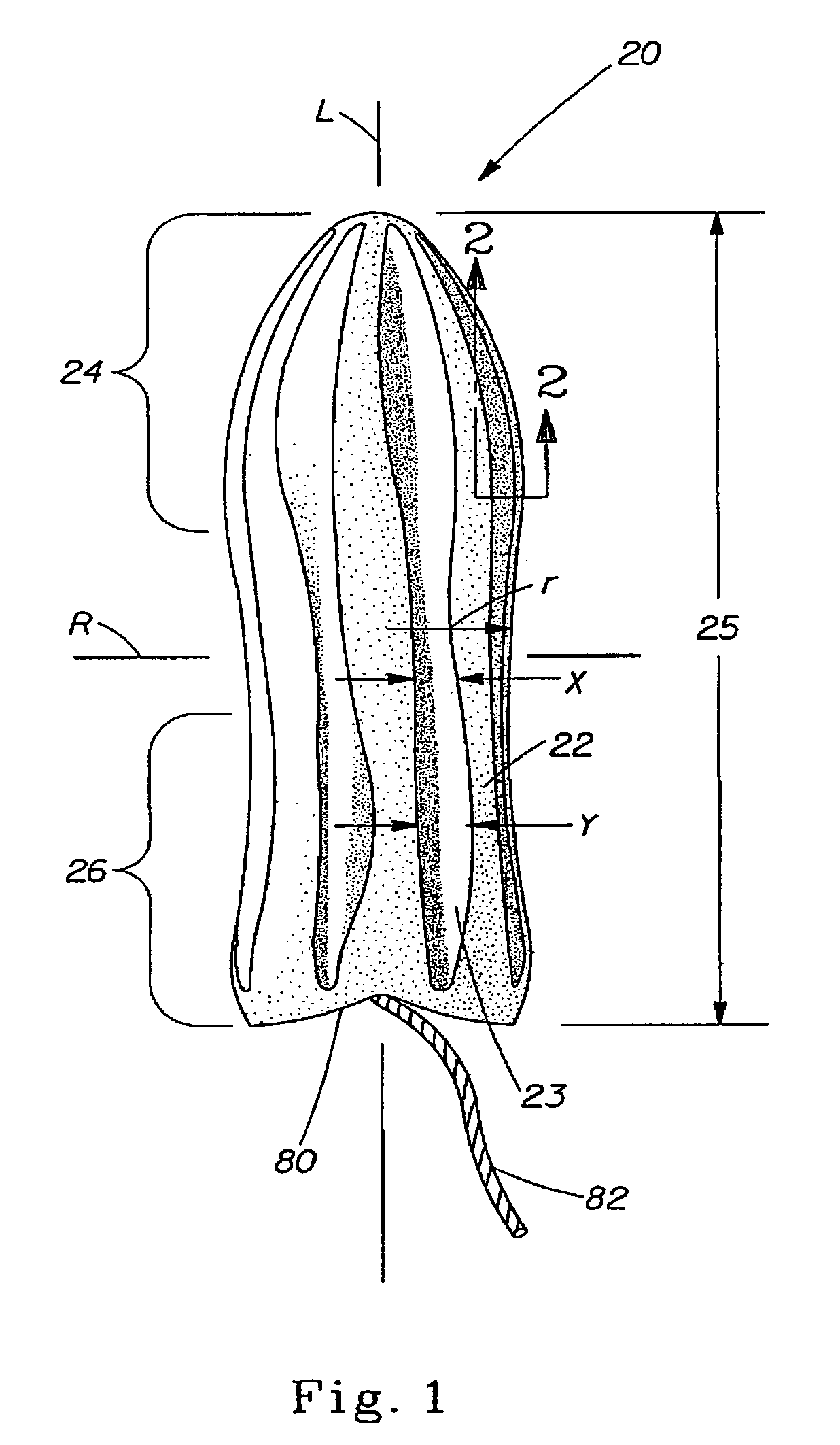 Tampon having recessed portions