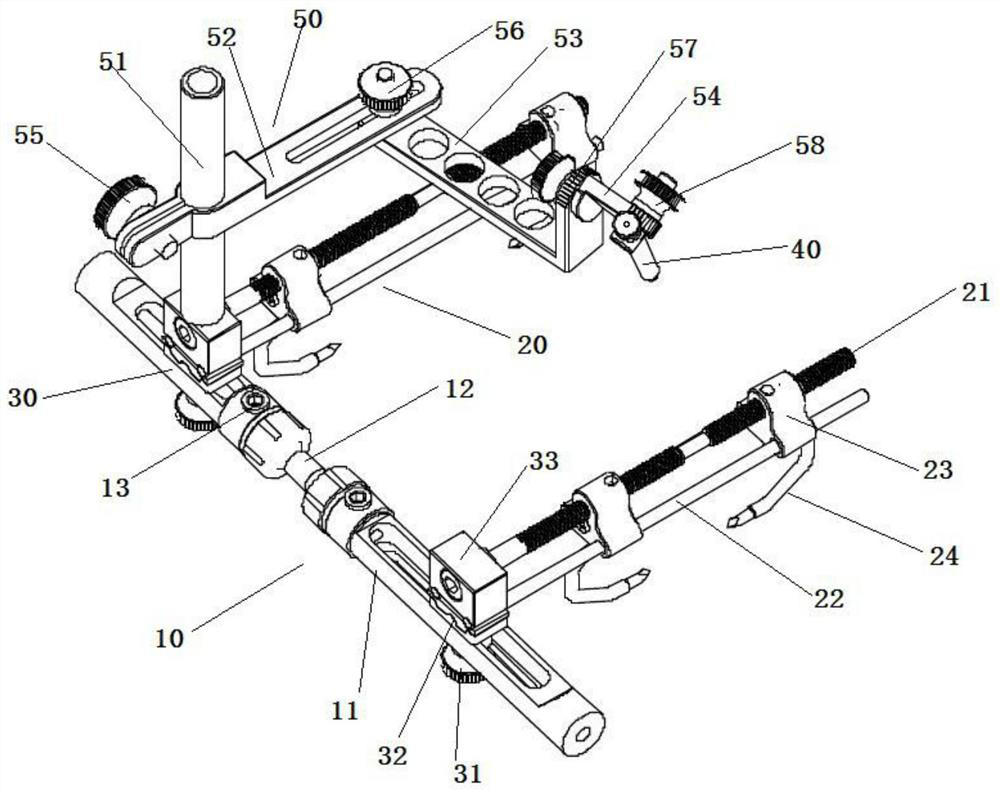 An external fixation bracket for minimally invasive percutaneous fixation of the scaphoid