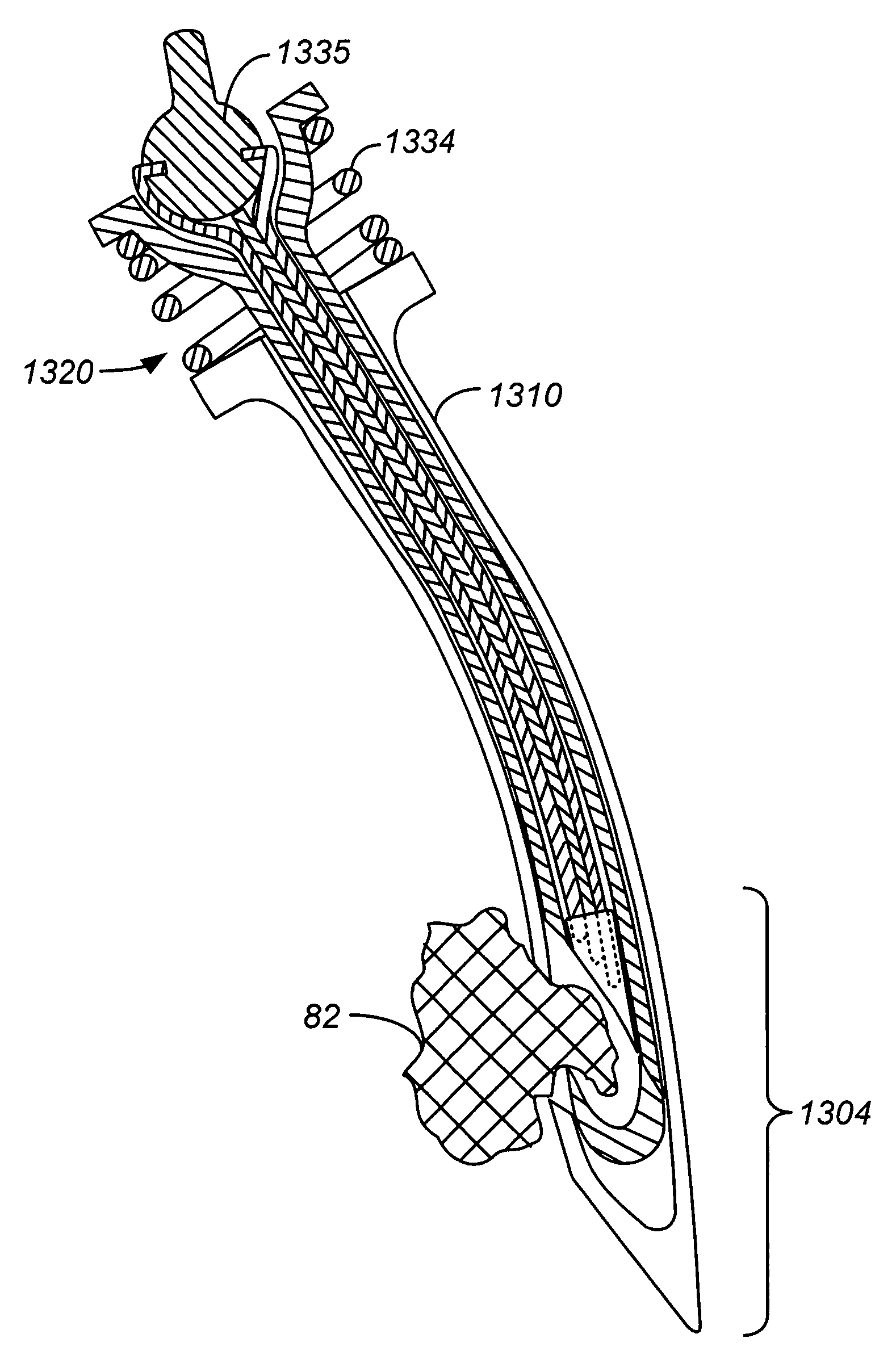 Steerable device for accessing a target site and methods