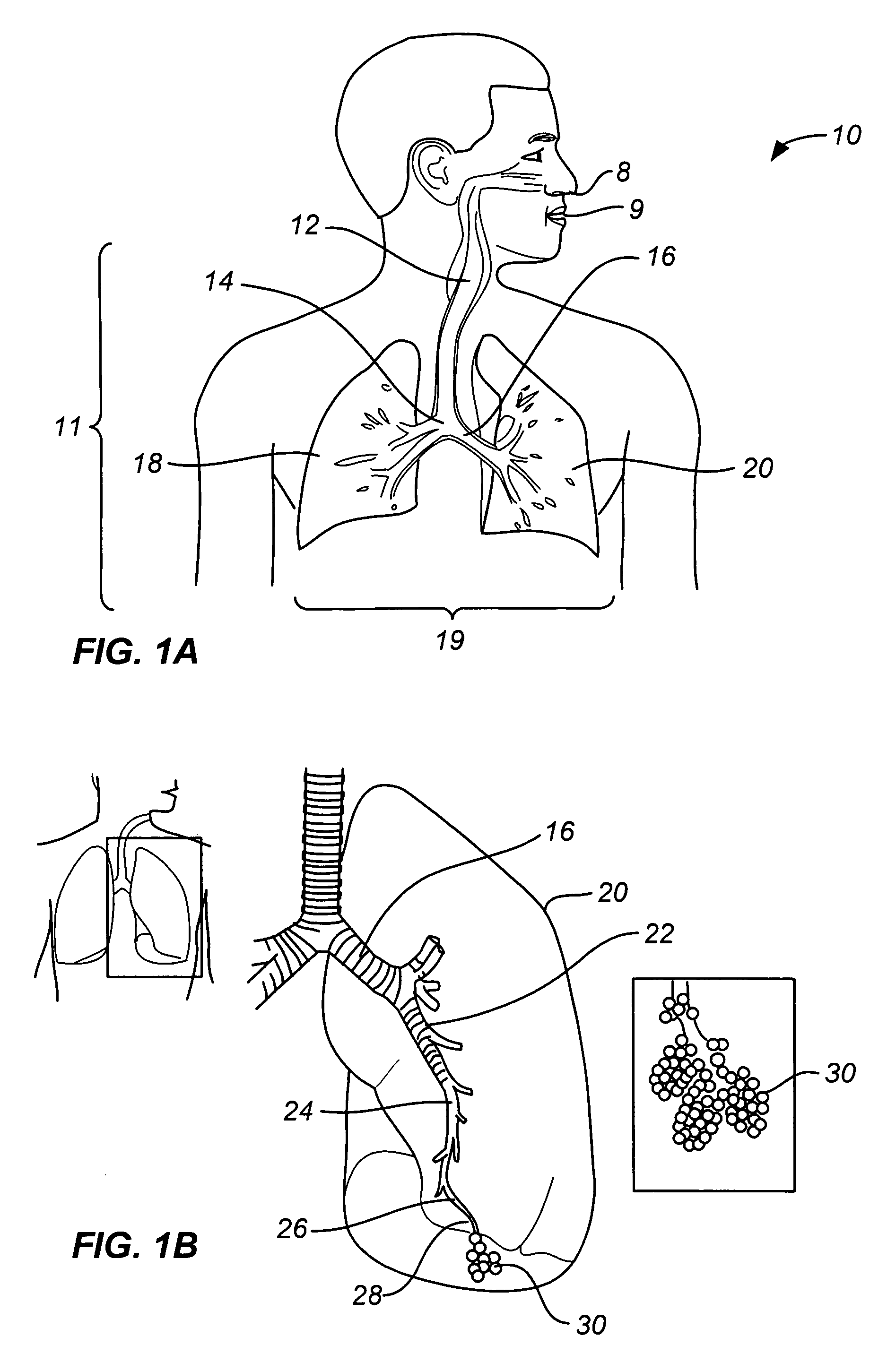 Steerable device for accessing a target site and methods