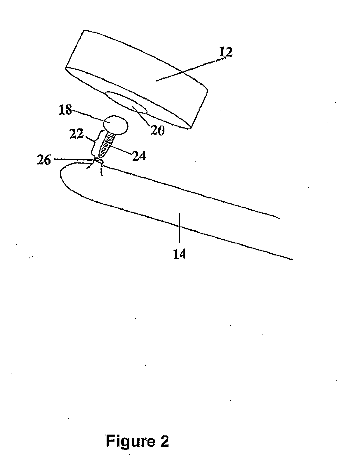 Method of determining blood pressure and an apparatus for determining blood pressure