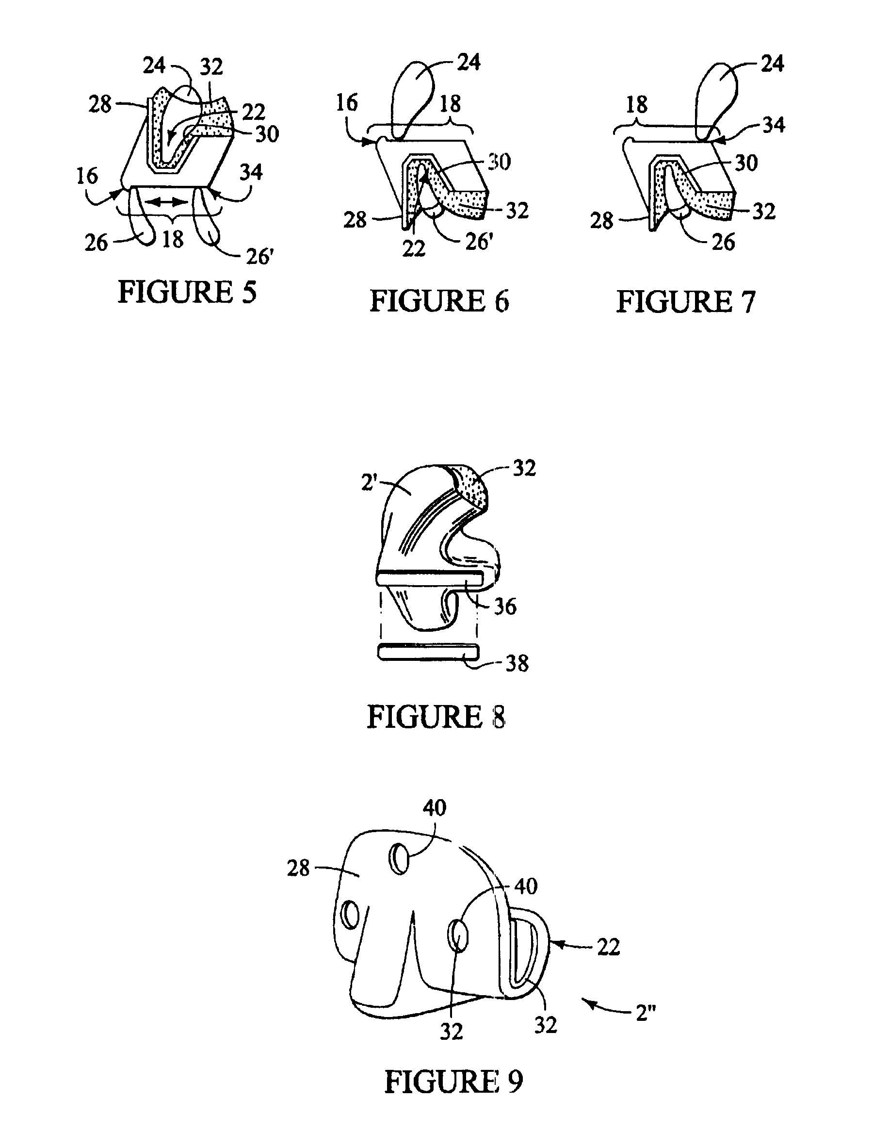 Intraoral discluder device and method for preventing migraine and tension headaches and temporomandibular disorders