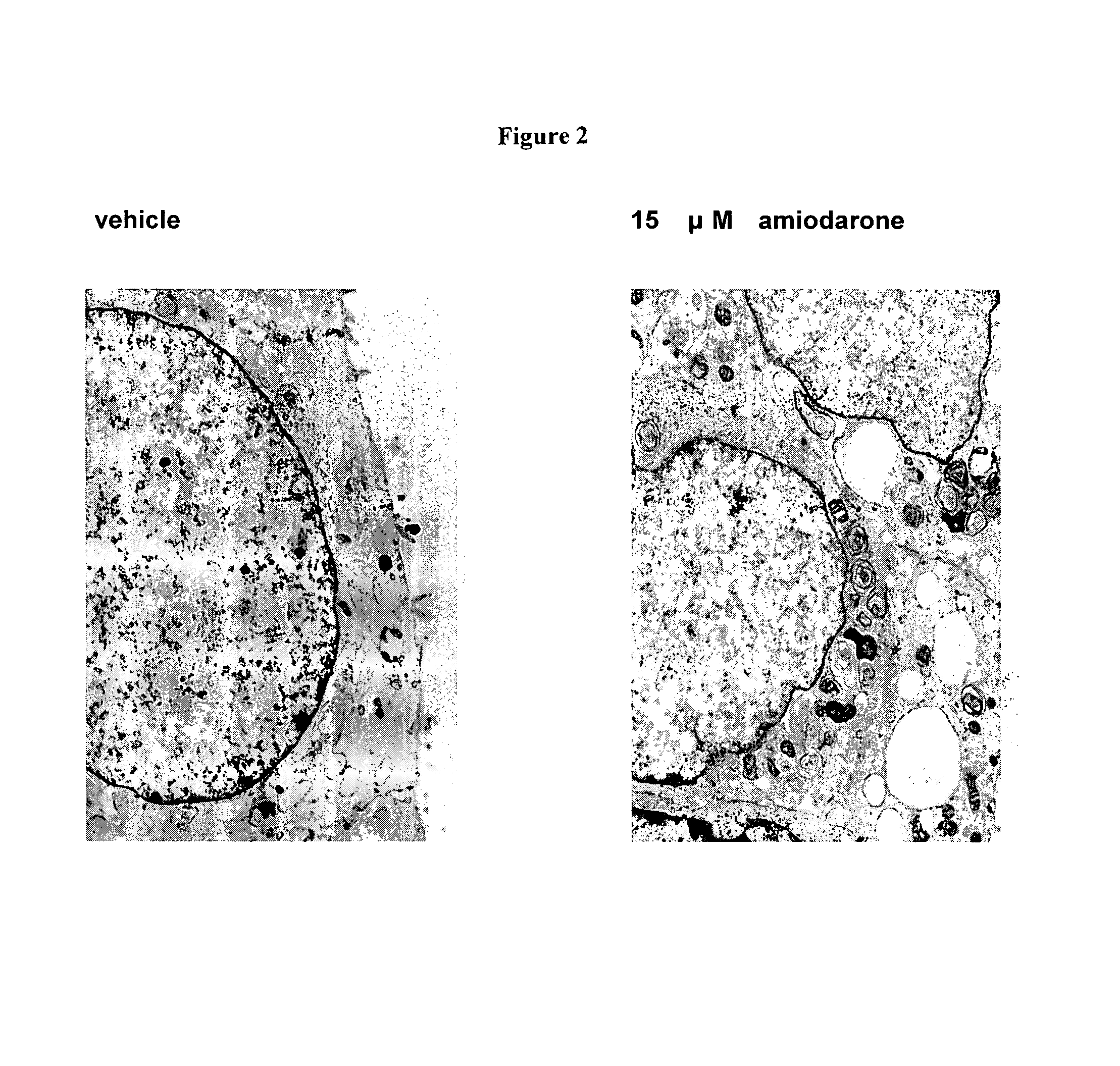 Methods and compositions for using aleveolar macrophage phospholipase A2