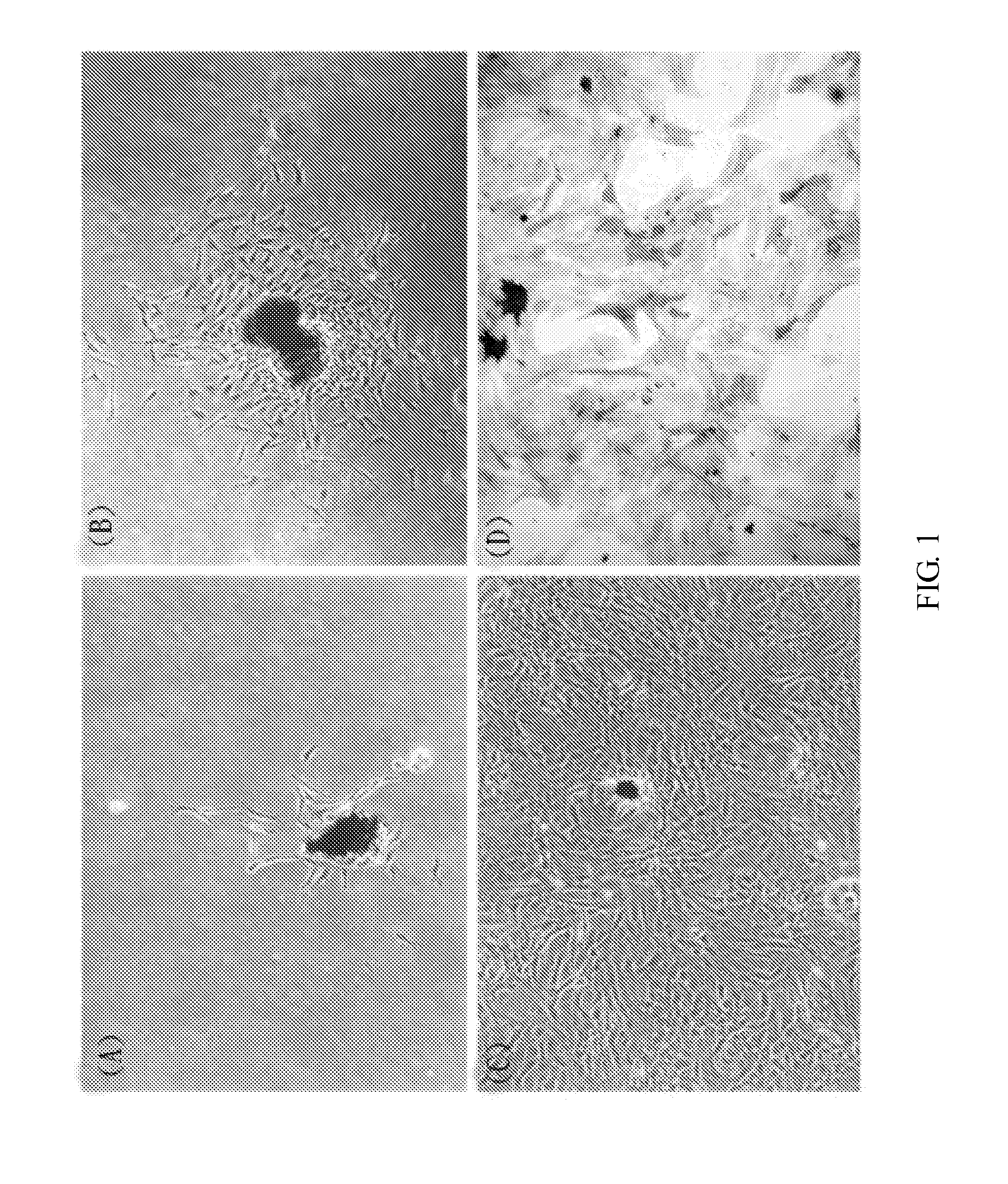 Pharmaceutical Composition for Inhibiting Histone H4 and Manufacturing Method Thereof