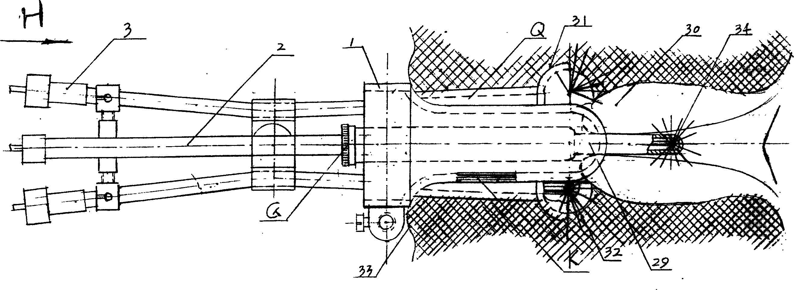 Protection device for gynecological tumor in-cavity radiotherapy