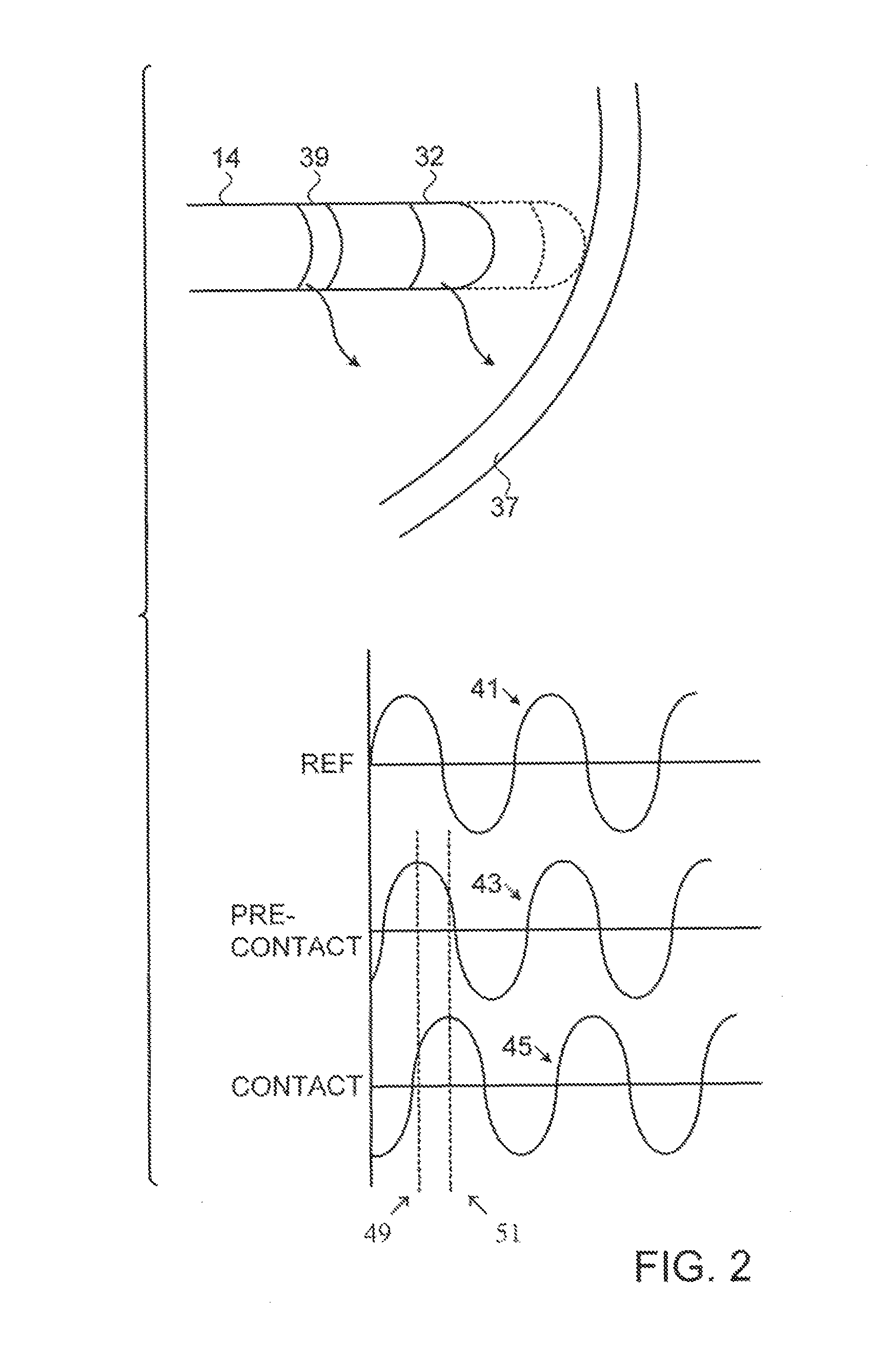 Machine learning in determining catheter electrode contact