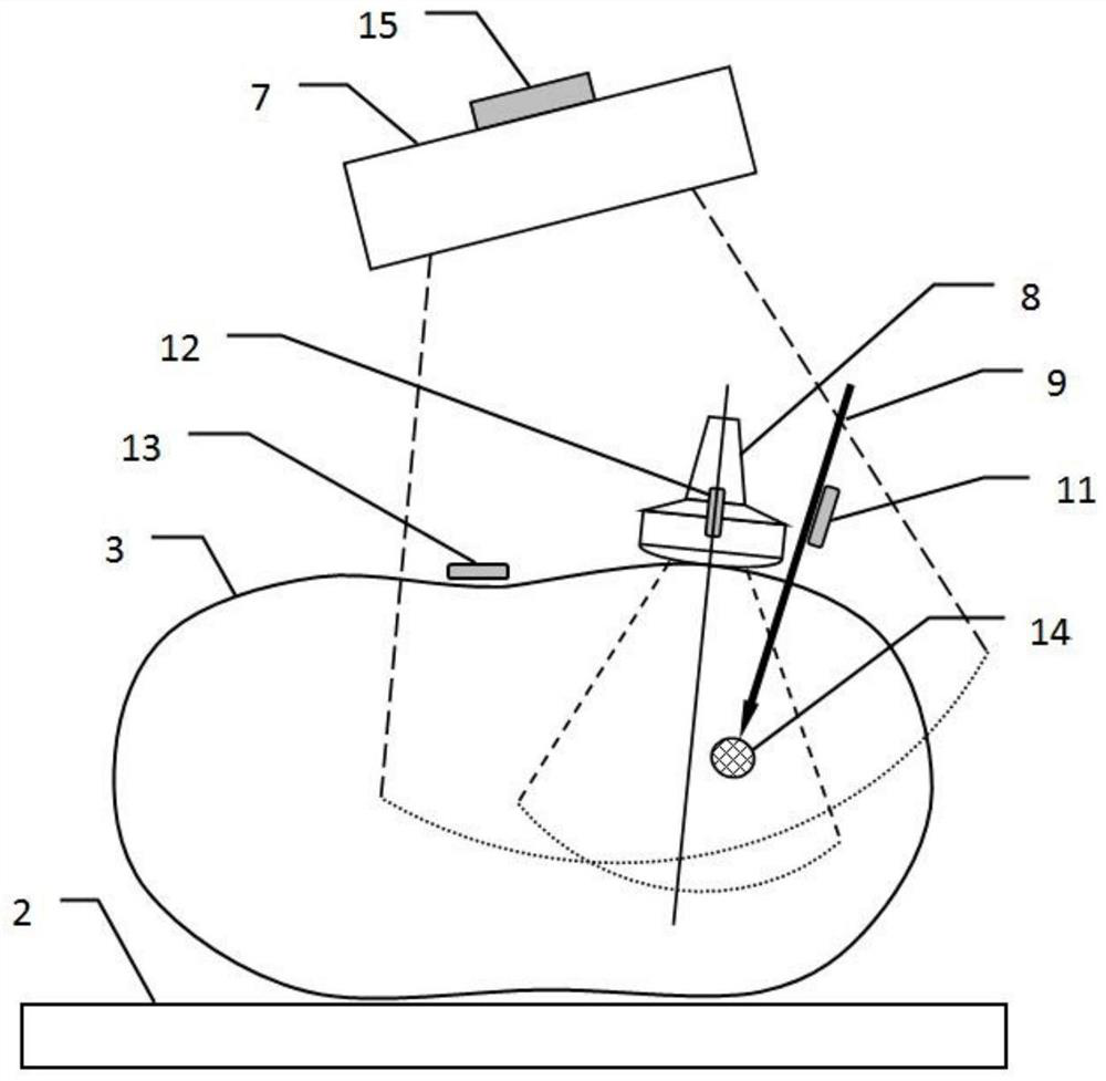 A minimally invasive interventional guidance system and method for ct and ultrasound image fusion