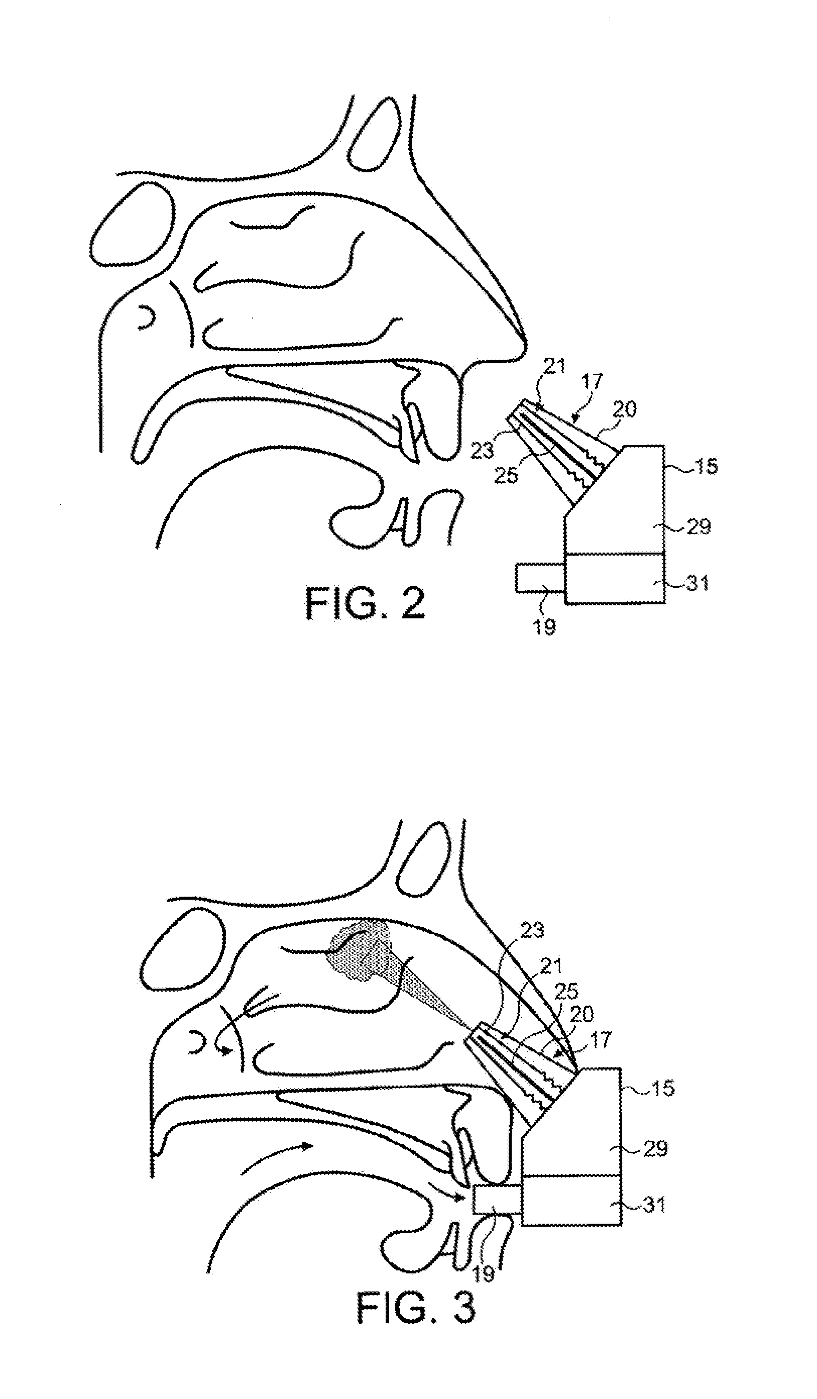 Intranasal administration