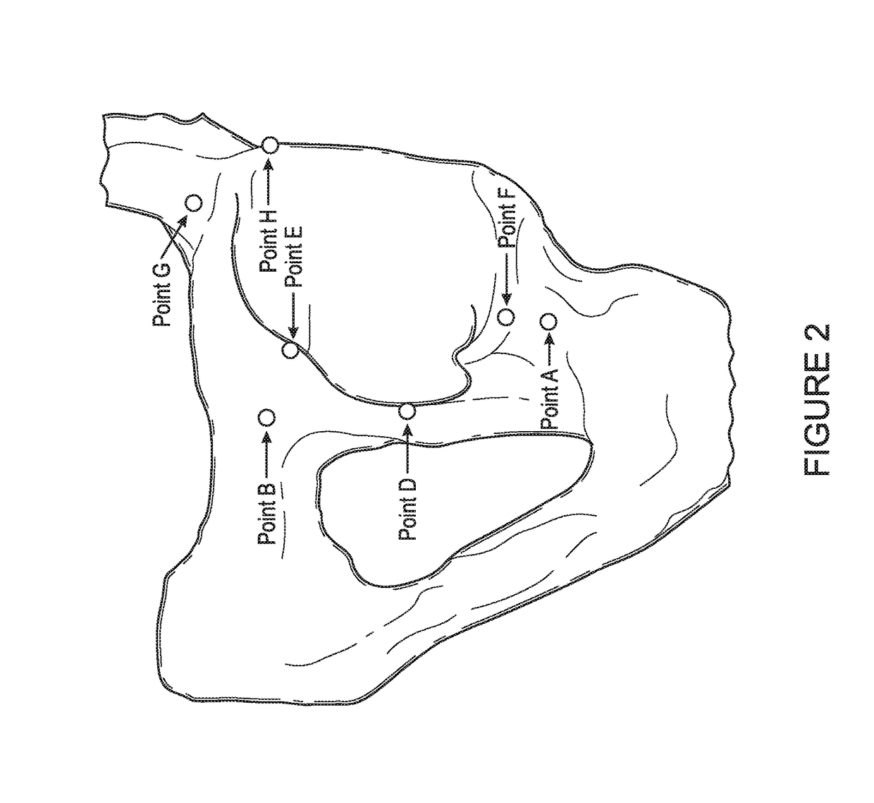 Hip replacement navigation system and method