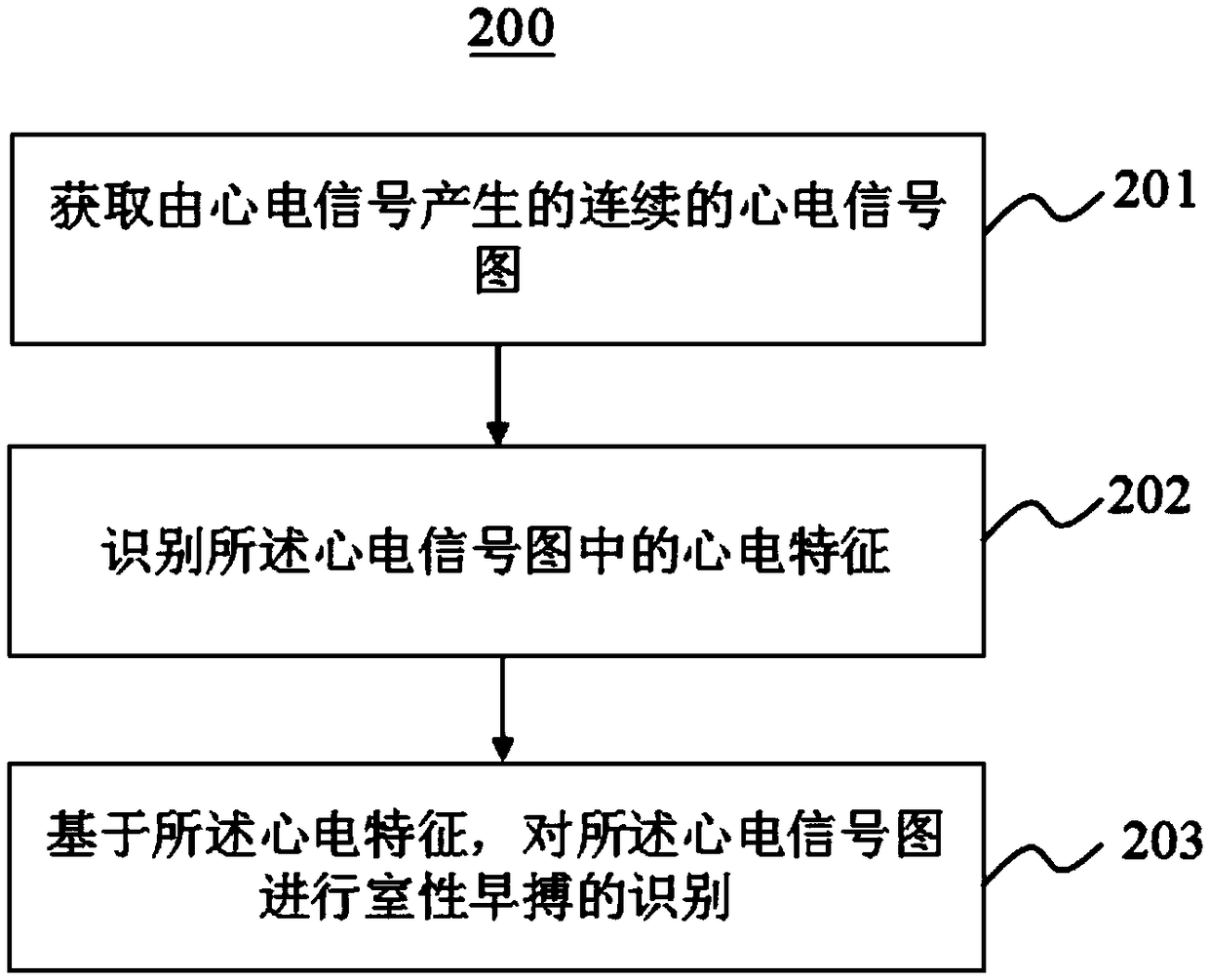 Ventricular premature beat recognition method, recognition system and electronic equipment