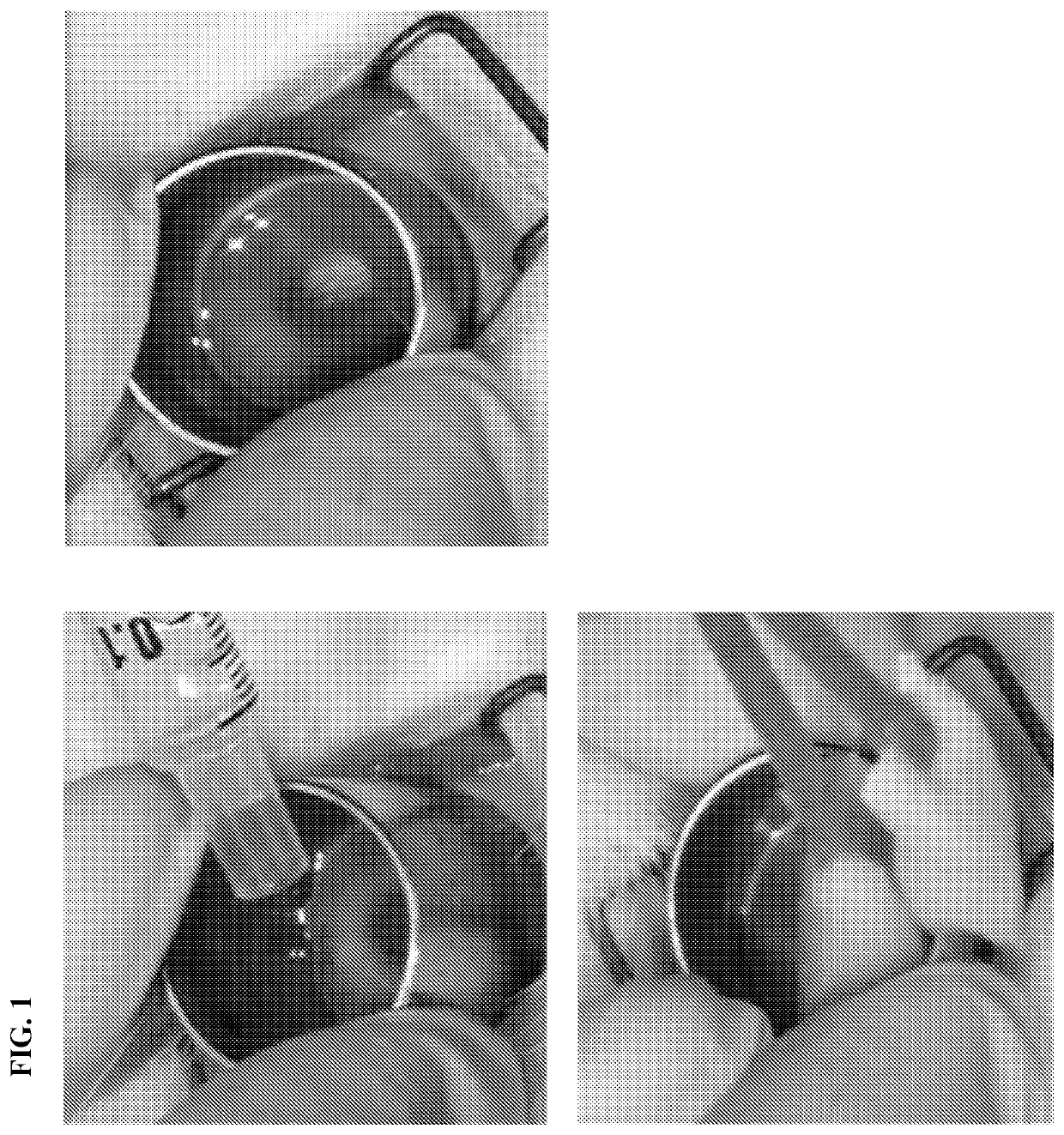 Proteasome modulation for treatment of corneal disorders