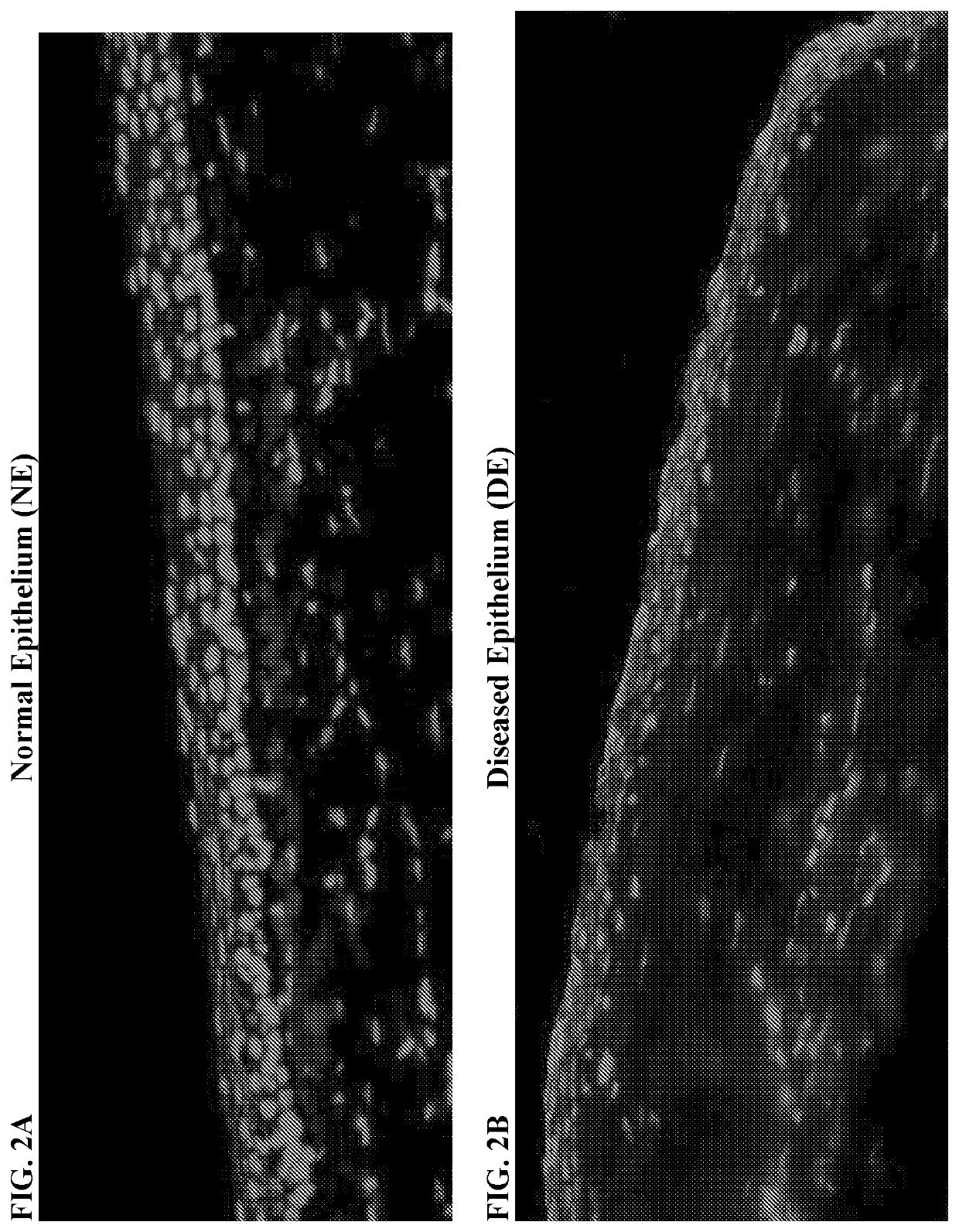 Proteasome modulation for treatment of corneal disorders