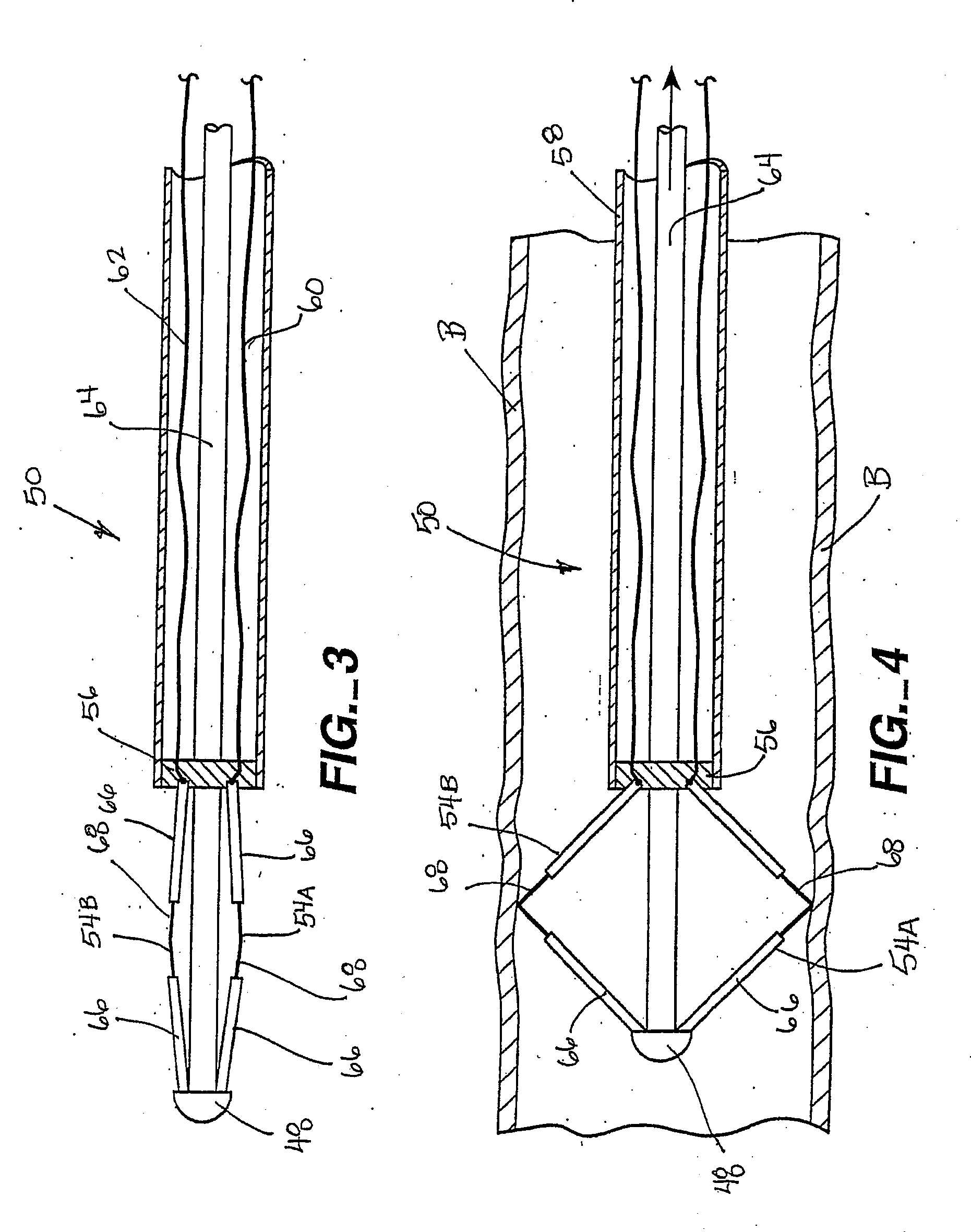 Expandable electode devices and methods of treating bronchial tubes